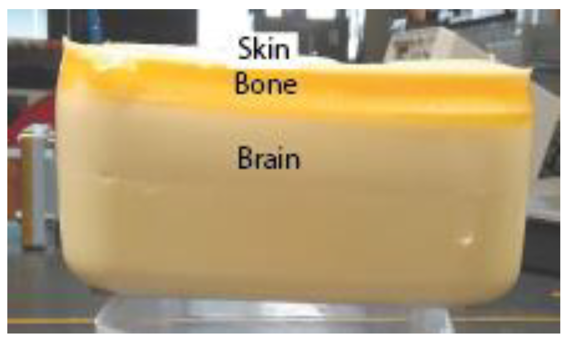 Electronics 09 01099 g011