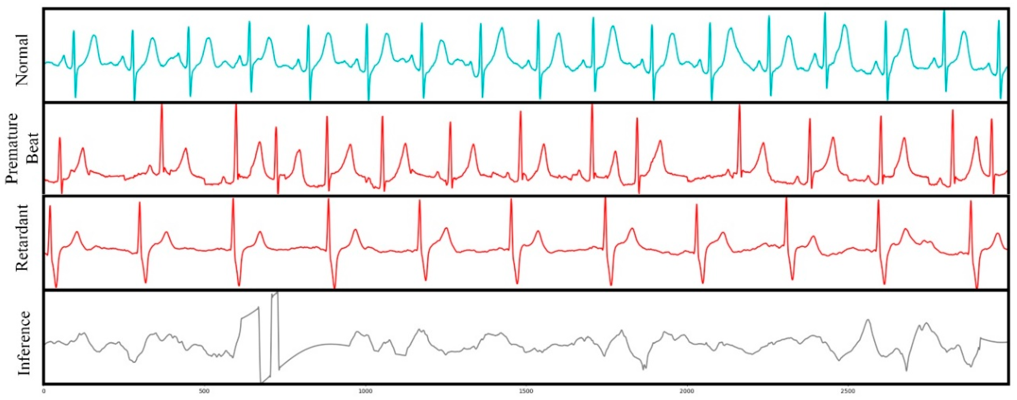 Electronics 09 01753 g005