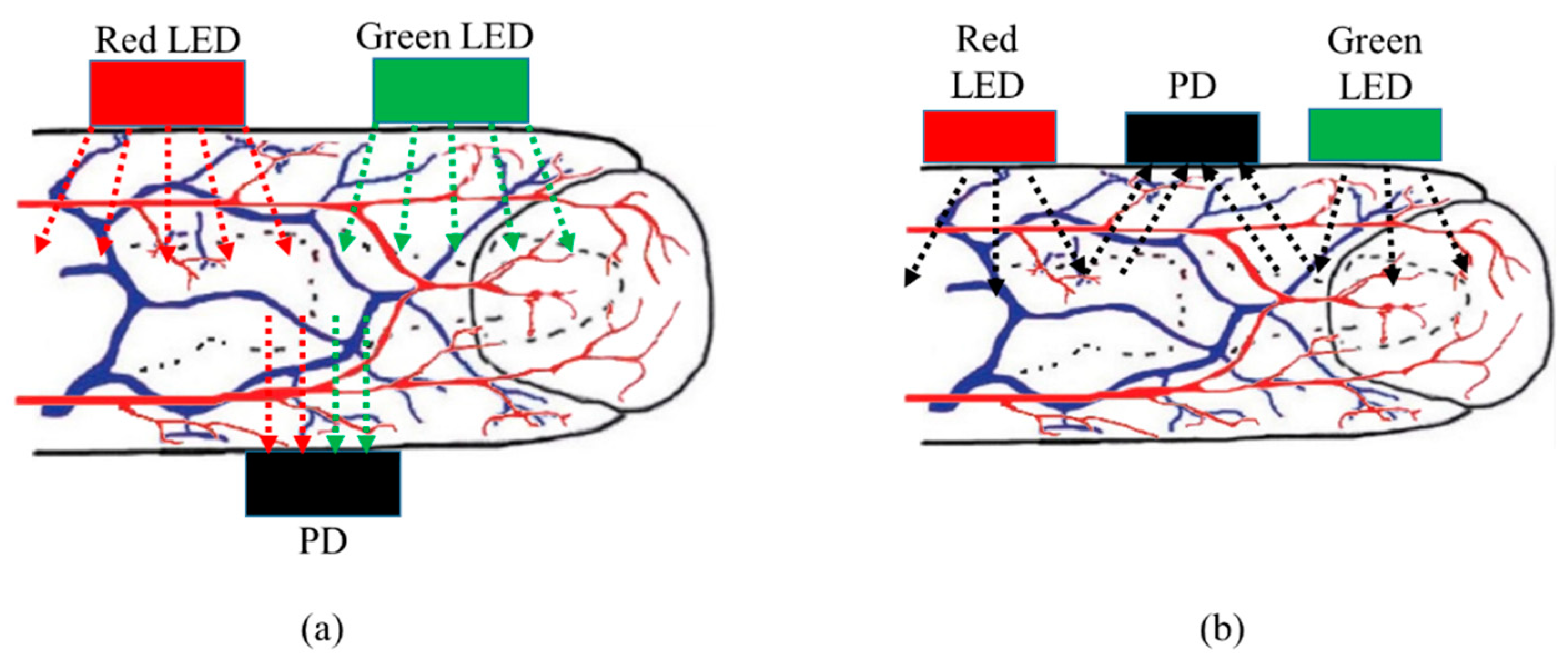 Electronics 09 01905 g003 Electronics 09 01905 g003