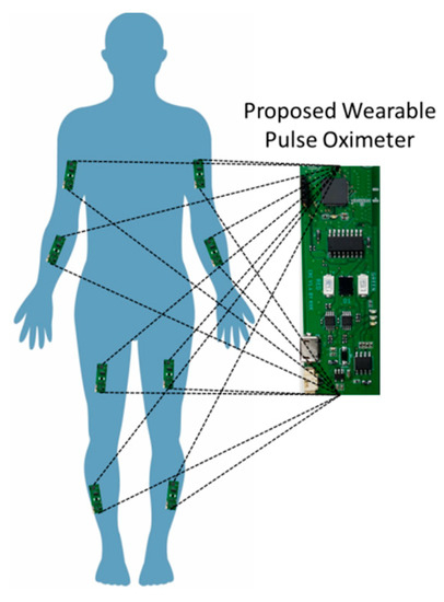 Electronics Free Full Text Development of a Wearable