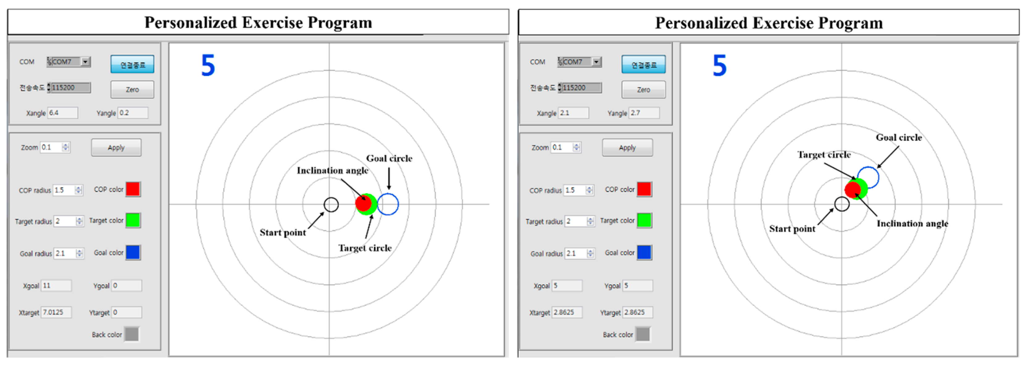 Electronics Free Full Text Effects Of A Personalized Exercise Rehabilitation Device On Dynamic Postural Balance For Scoliotic Patients A Feasibility Study Html Electronics Free Full Text Effects Of A Personalized Exercise Rehabilitation Device On Dynamic Postural Balance For Scoliotic Patients A Feasibility Study Html