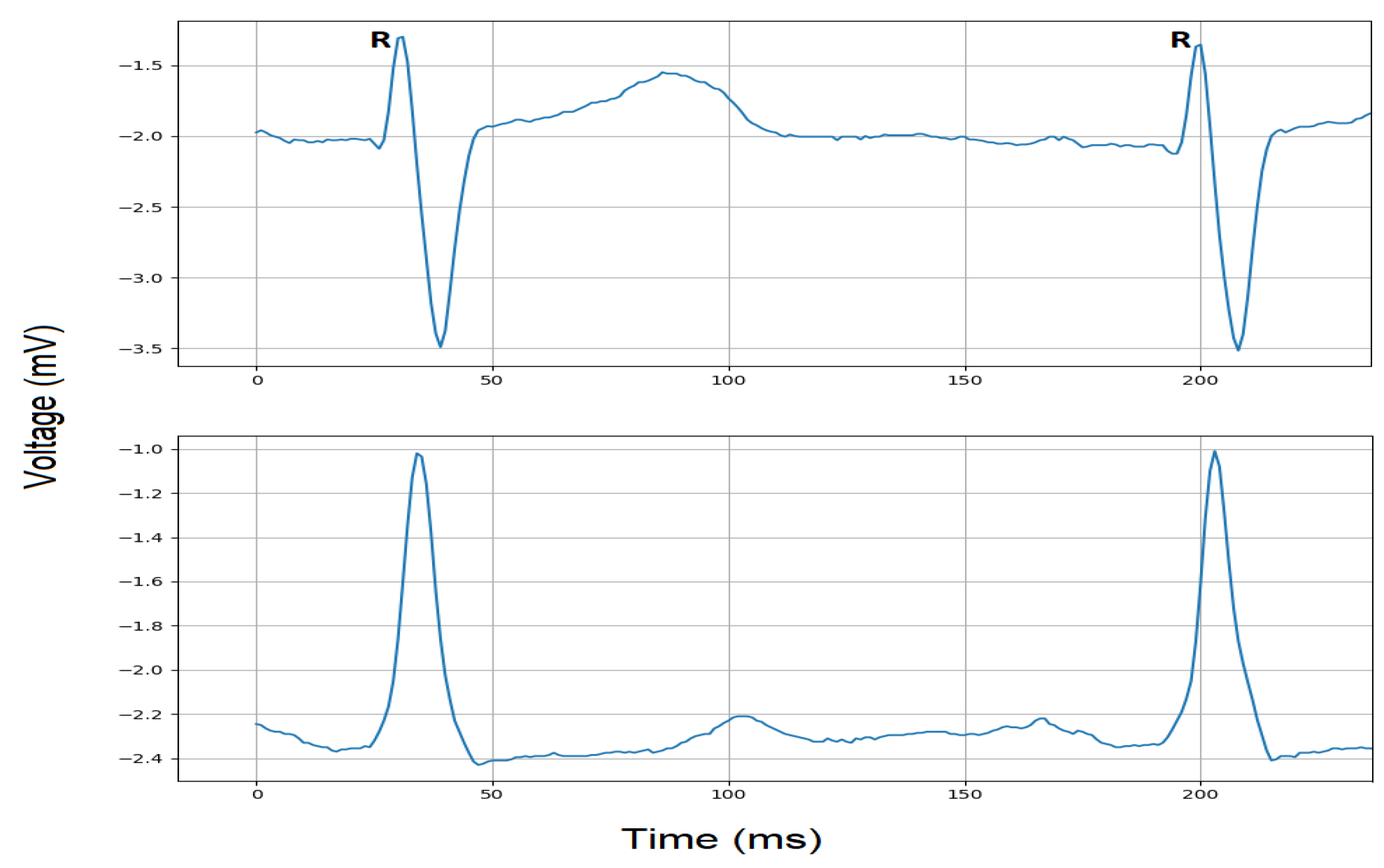 Electronics 10 00170 g004 Electronics 10 00170 g004