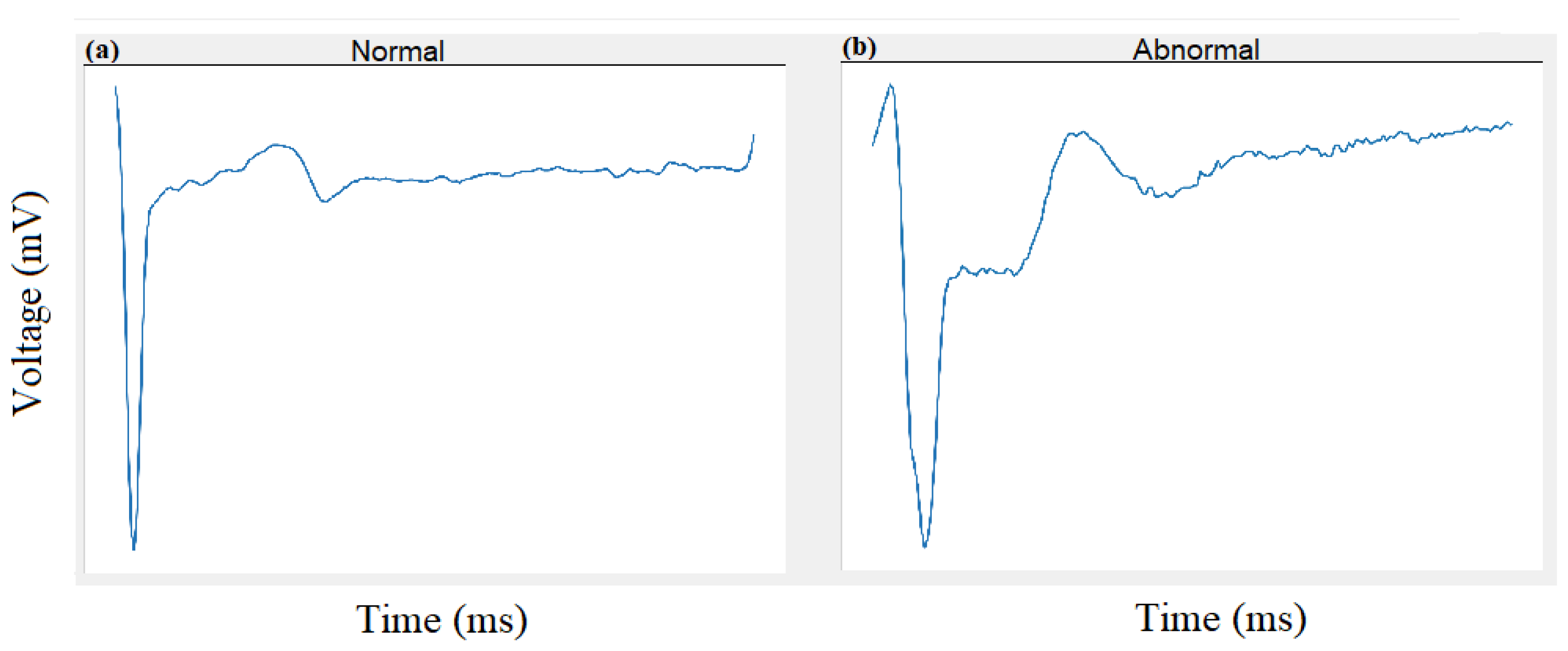 Electronics 10 00170 g007 Electronics 10 00170 g007