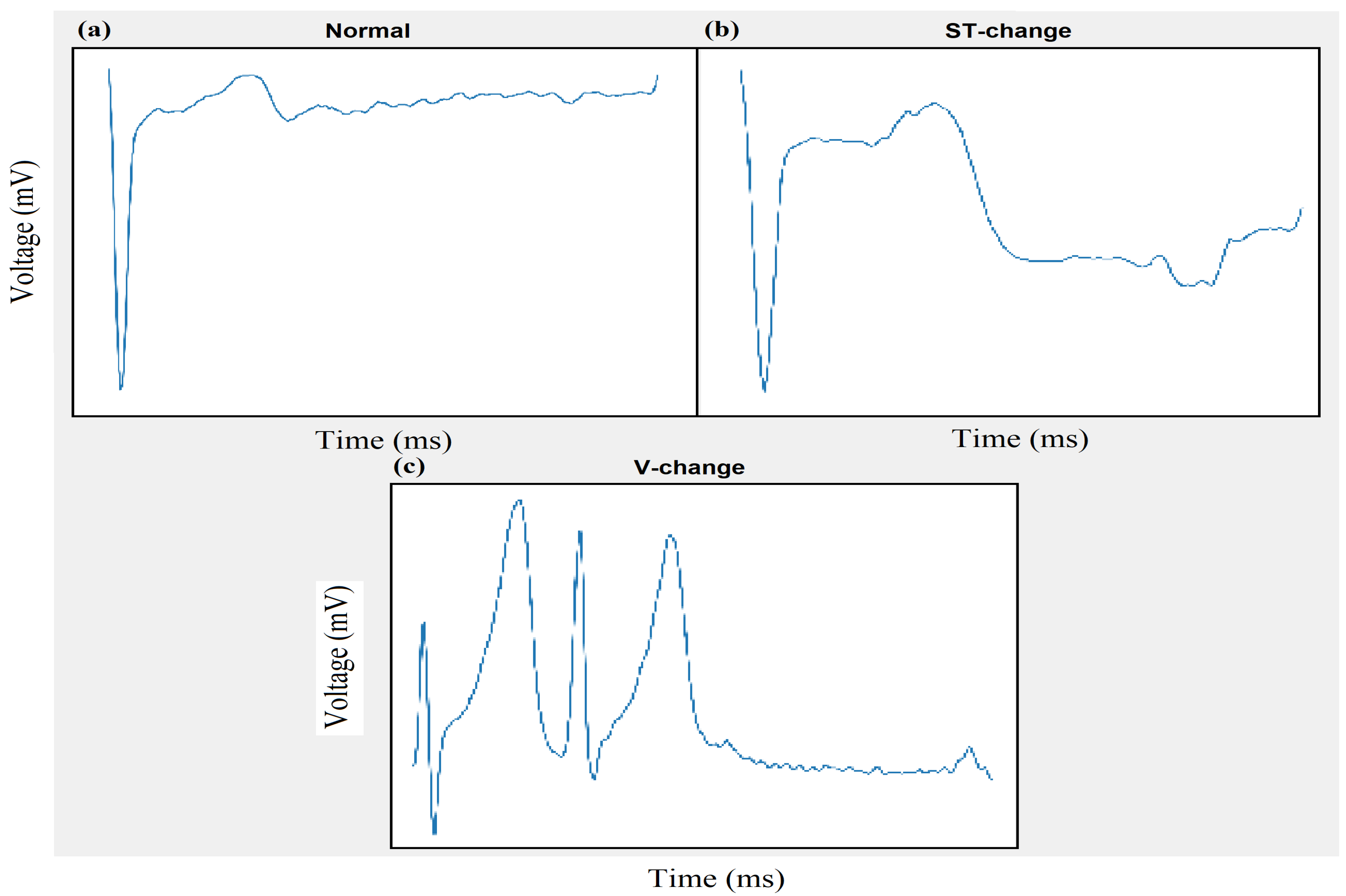 Electronics 10 00170 g011 Electronics 10 00170 g011