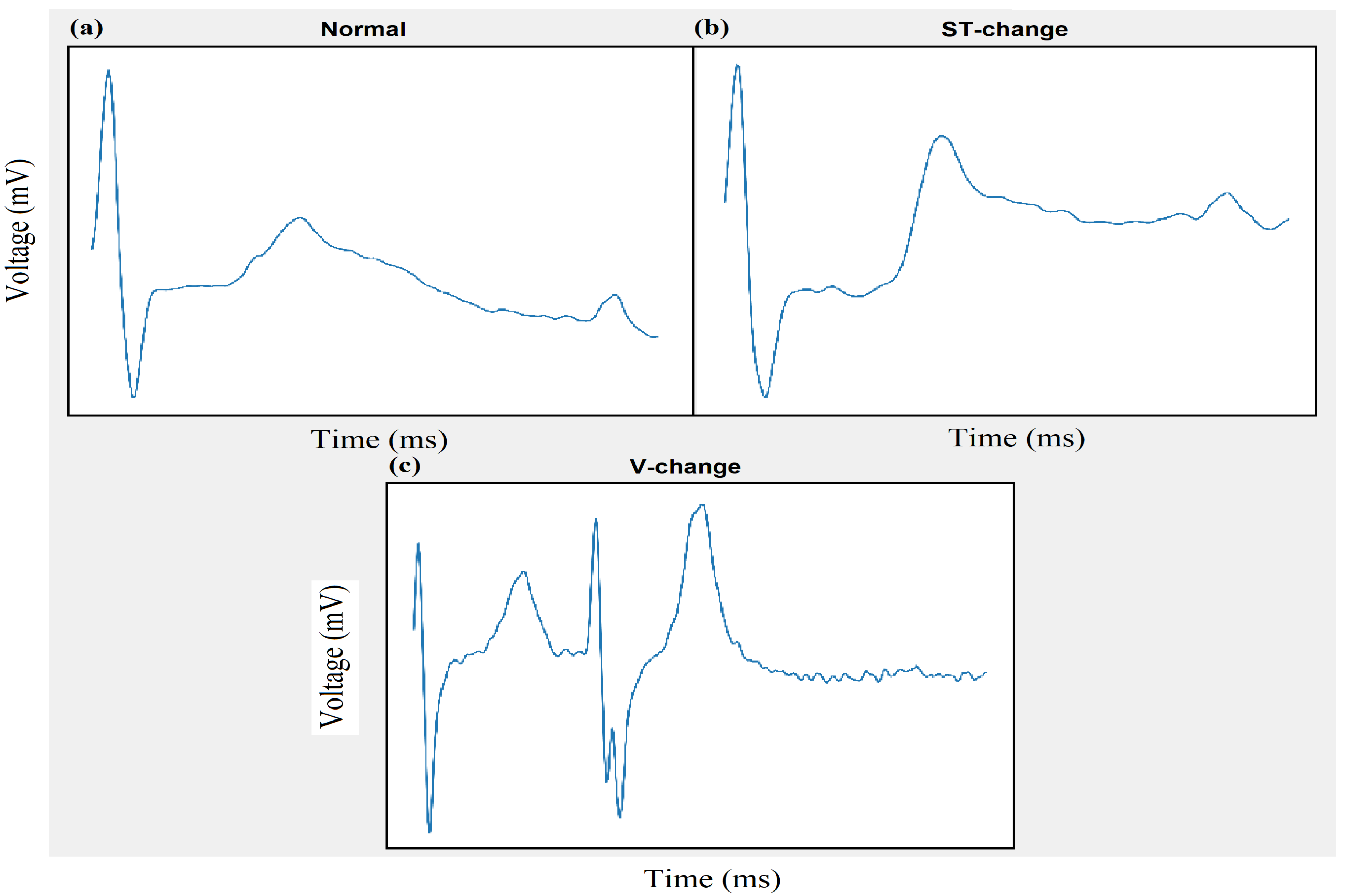 Electronics 10 00170 g014 Electronics 10 00170 g014