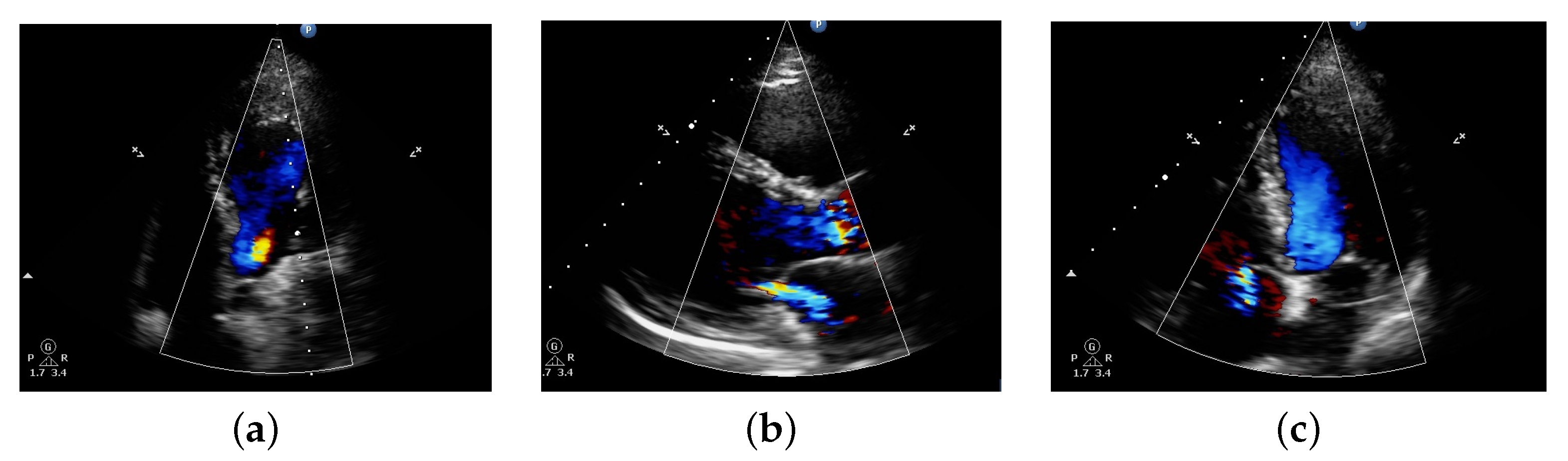Electronics 10 00495 g001