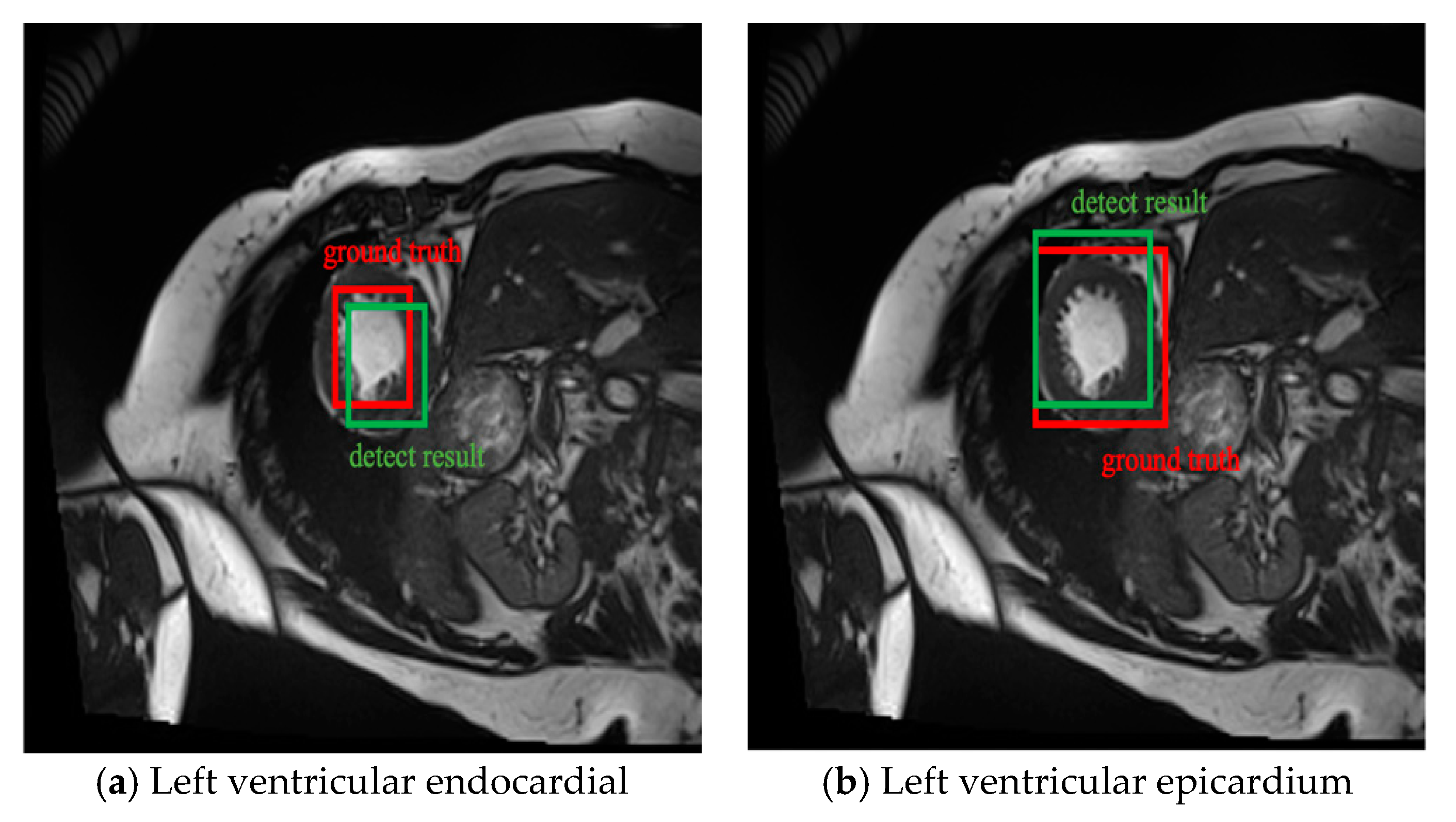 Electronics 10 00707 g003