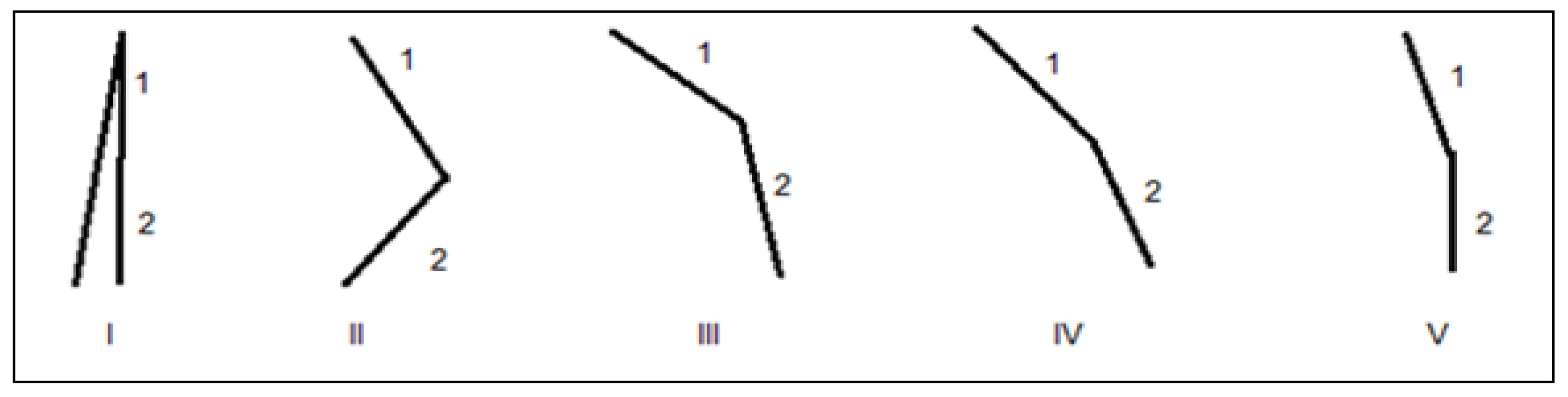 Electronics 10 00852 g001