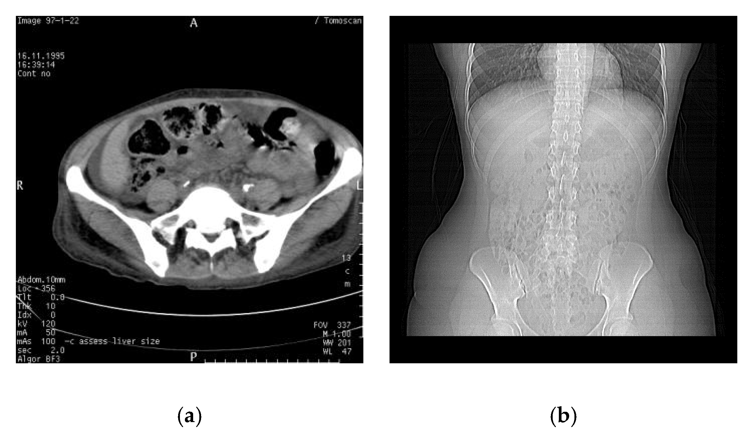 Electronics 10 00932 g004
