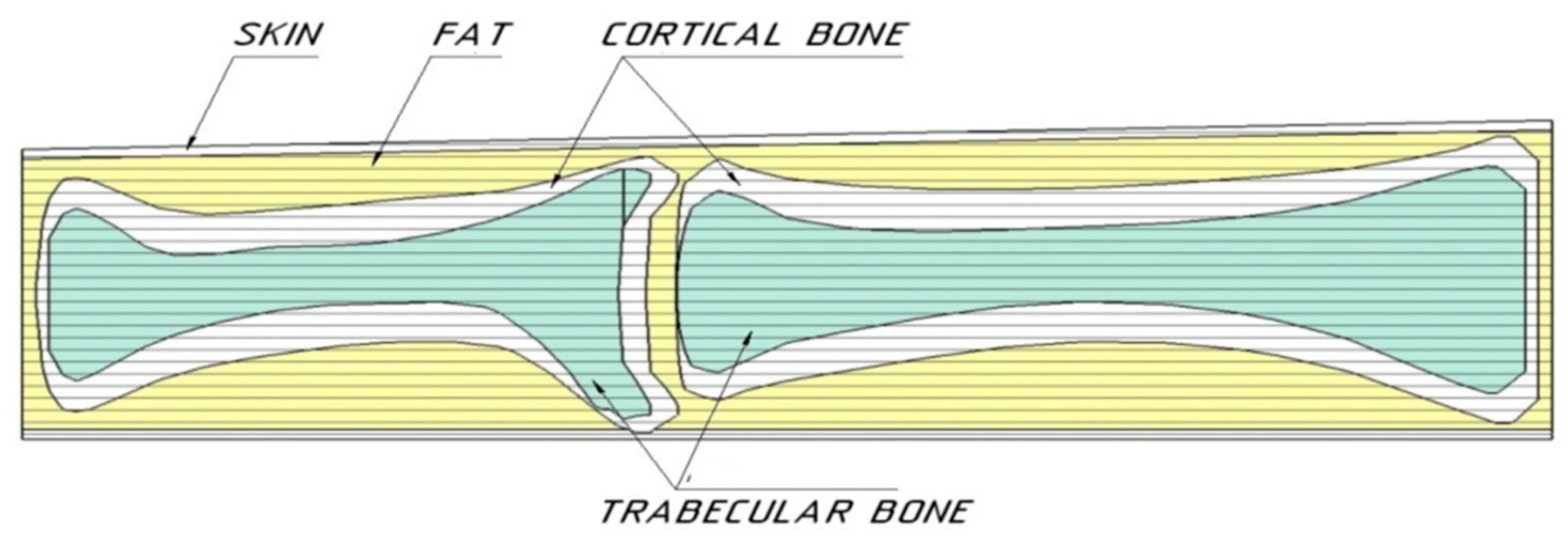 Electronics 10 01288 g010