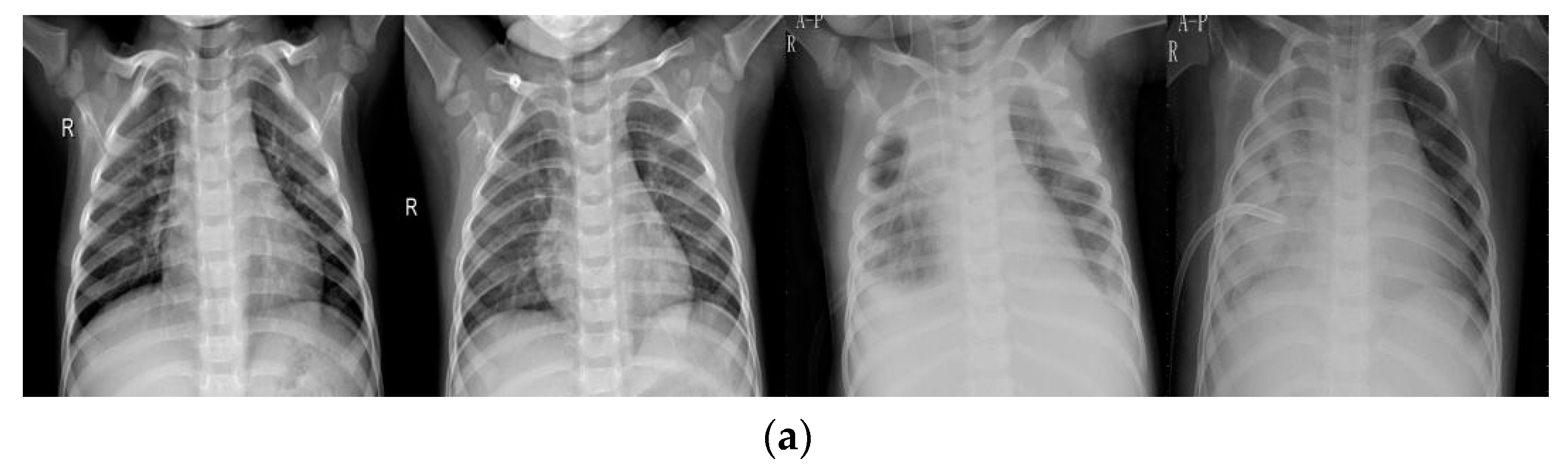 Electronics 10 01512 g002a