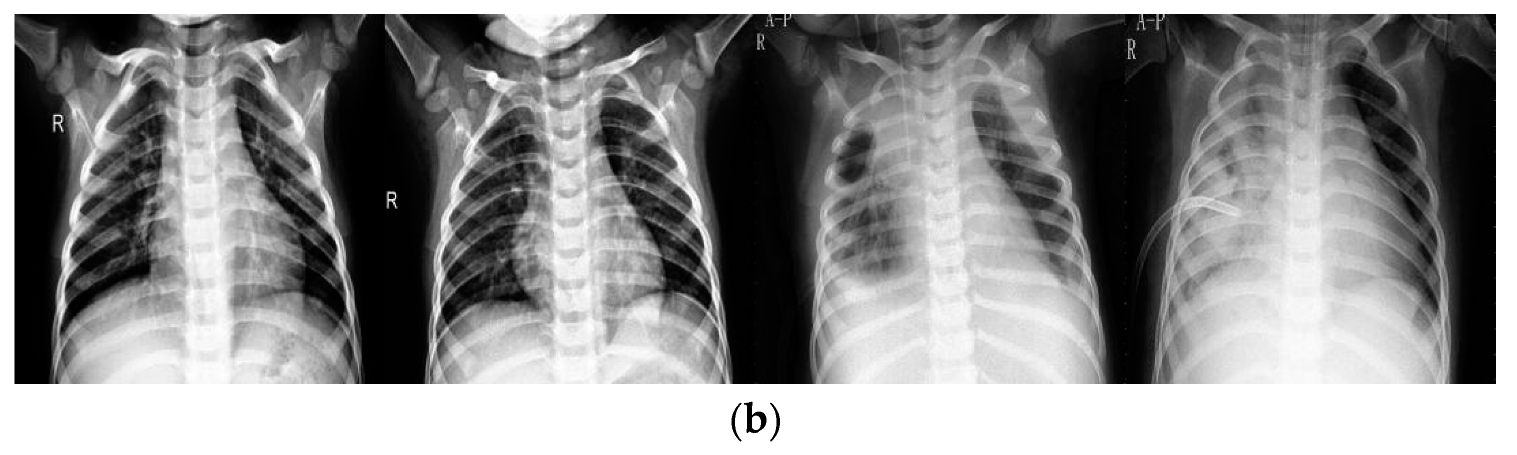 Electronics 10 01512 g002b
