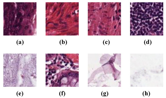 Deep Learning Techniques for the Classification of Colorectal Cancer Tissue