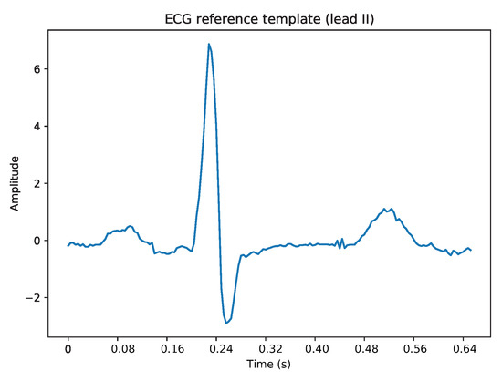 Time Series Segmentation Using Neural Networks with Cross-Domain ...
