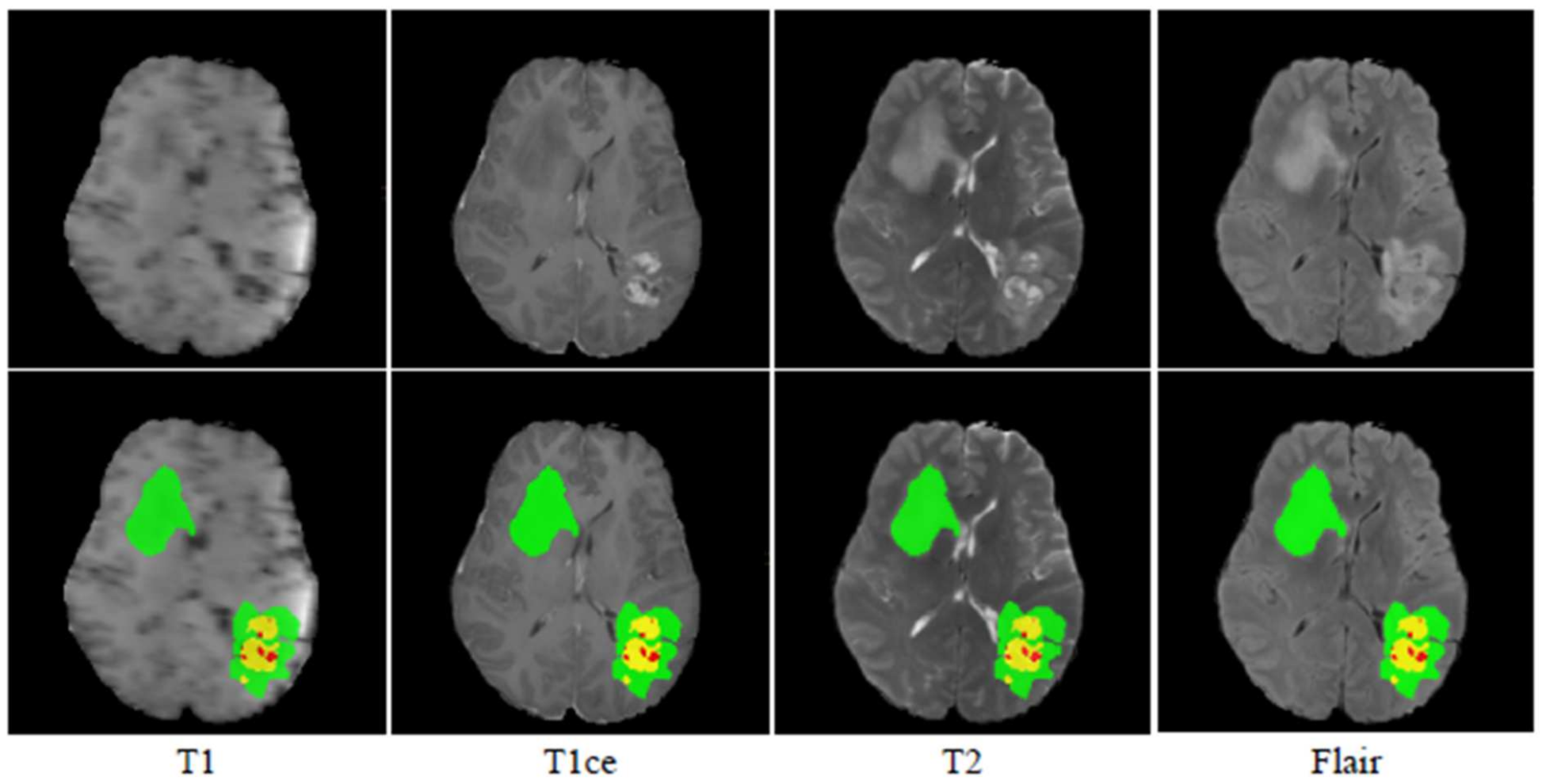 Electronics 10 01962 g004 550
