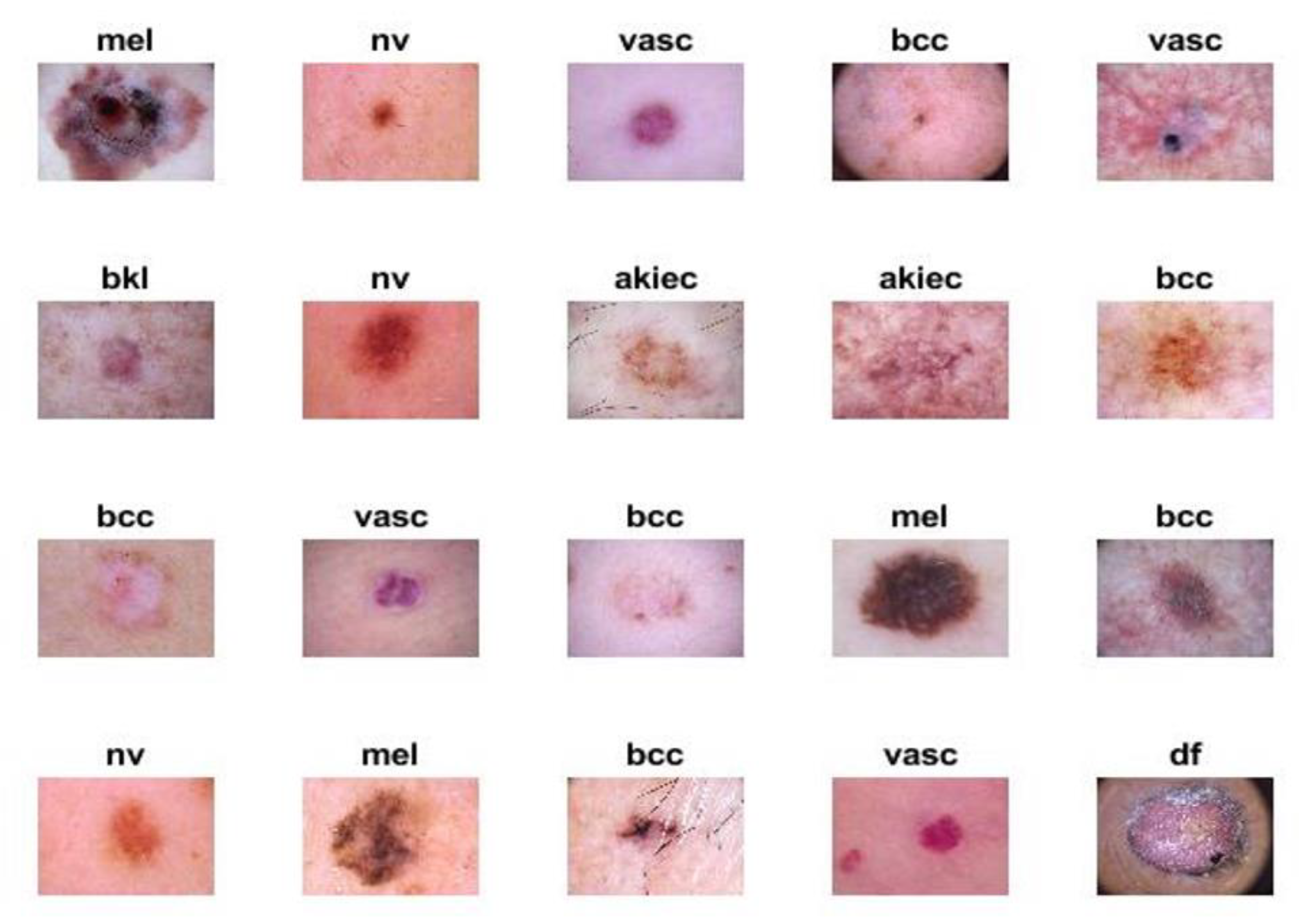 2冊The CurrentColorAtlas of Skin Diseases Skin Disease Classification versus Skin Lesion