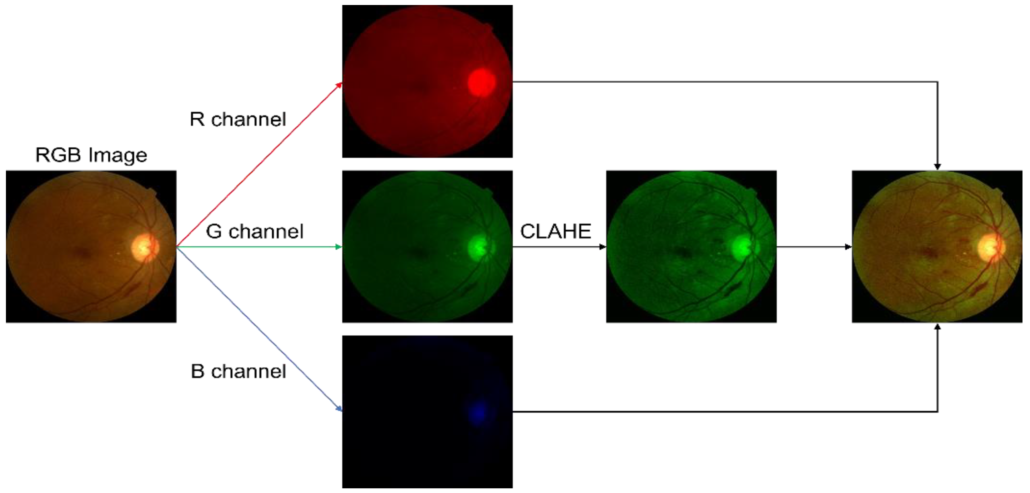 Electronics 11 00023 g005