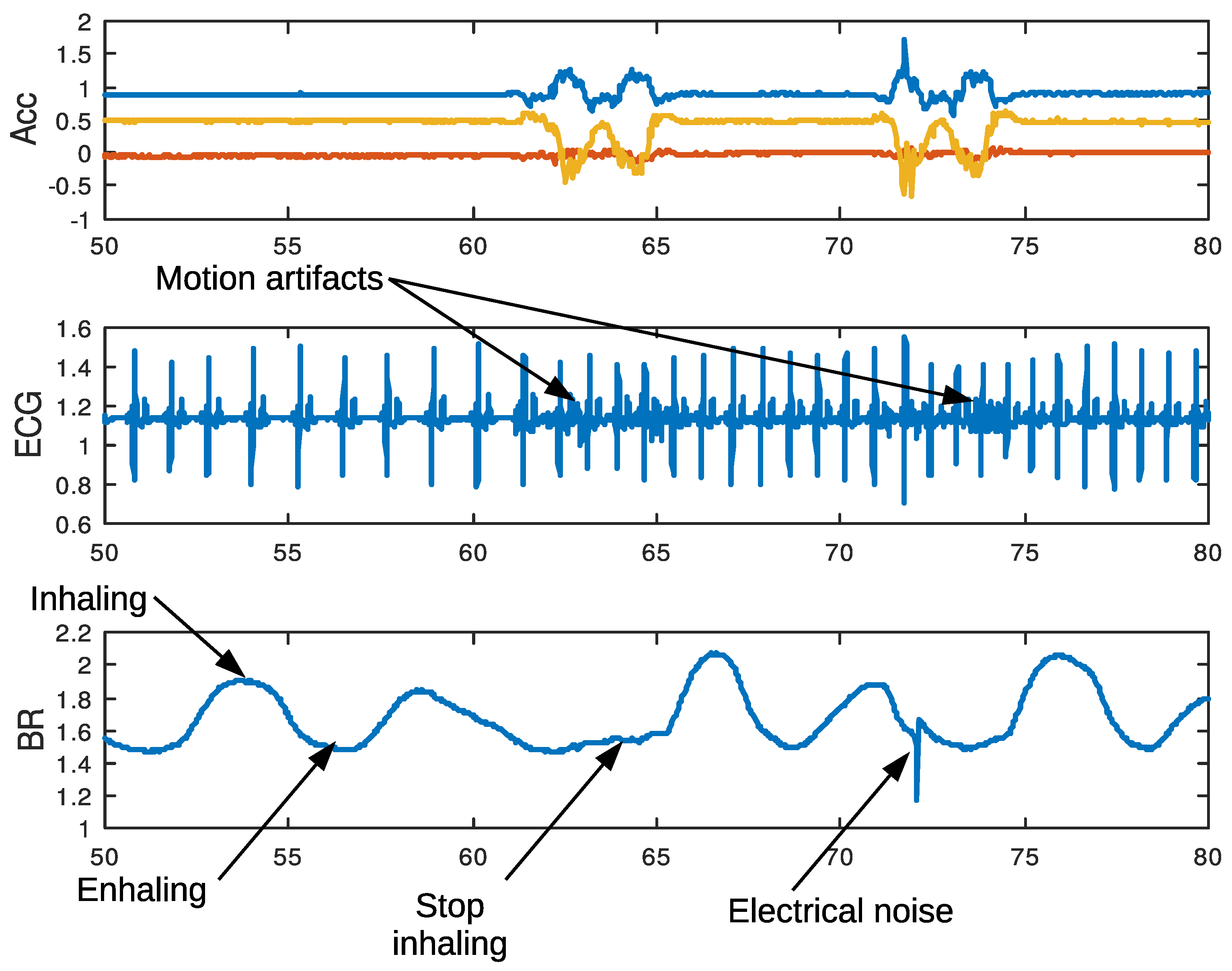 Electronics 11 00155 g014