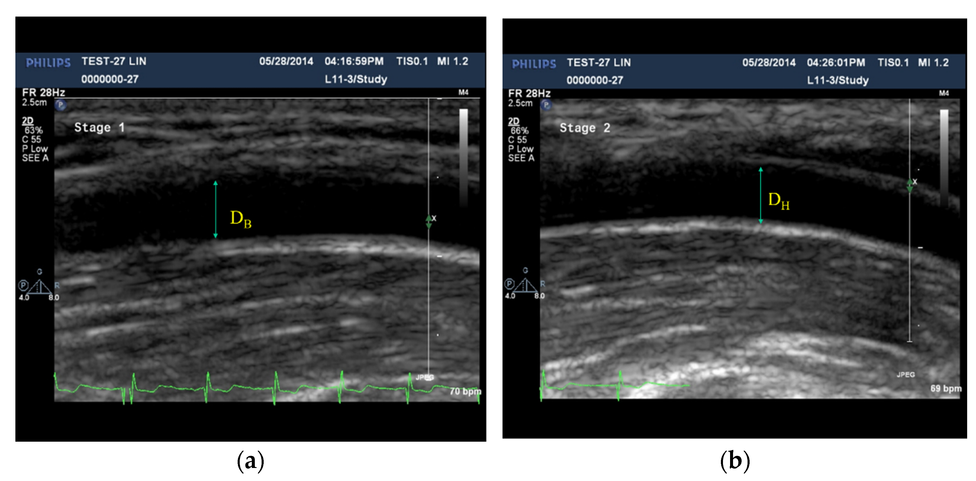 Electronics 11 00351 g005 550