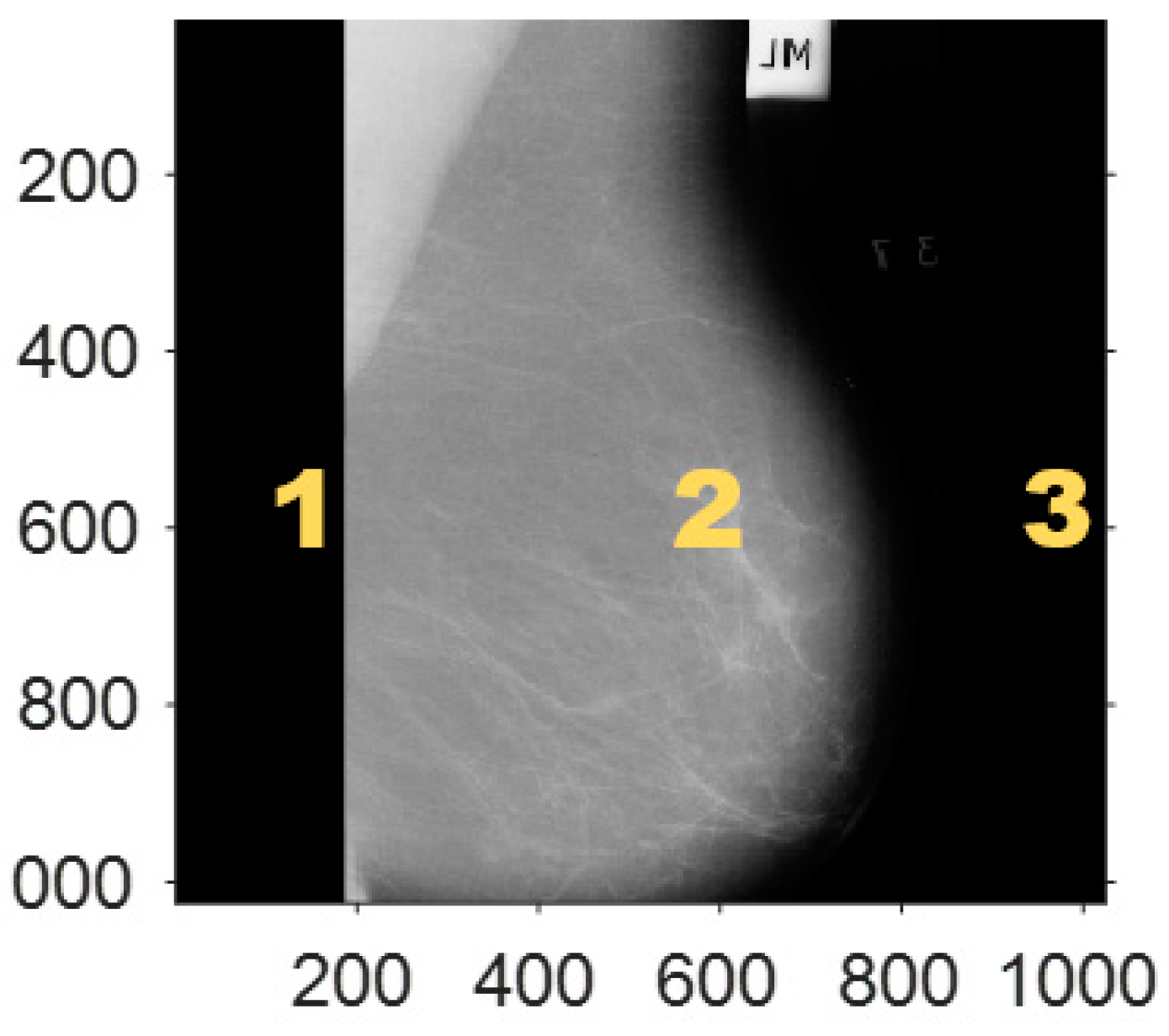 Electronics 11 00710 g001