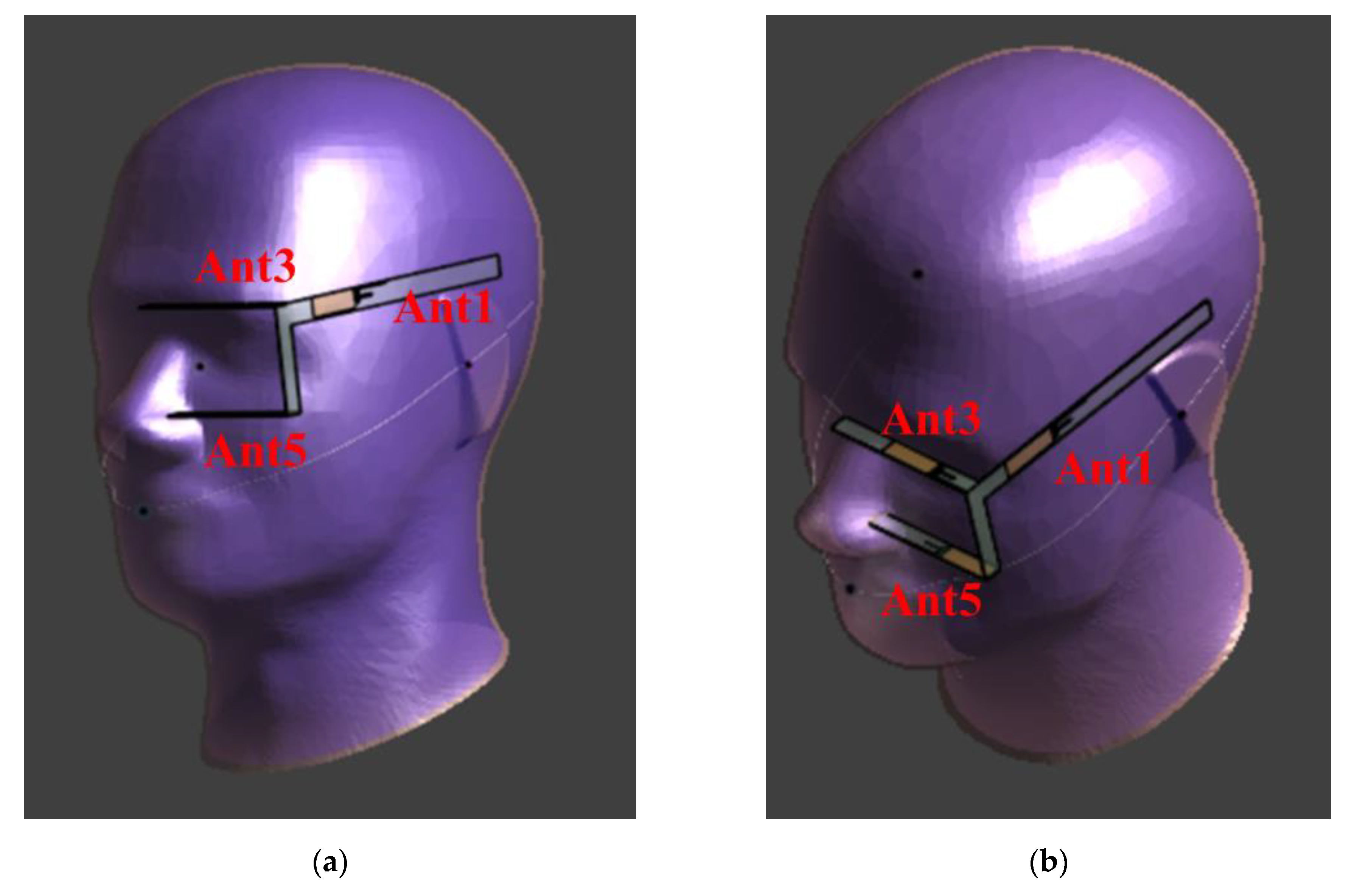 Electronics 11 00806 g005 550