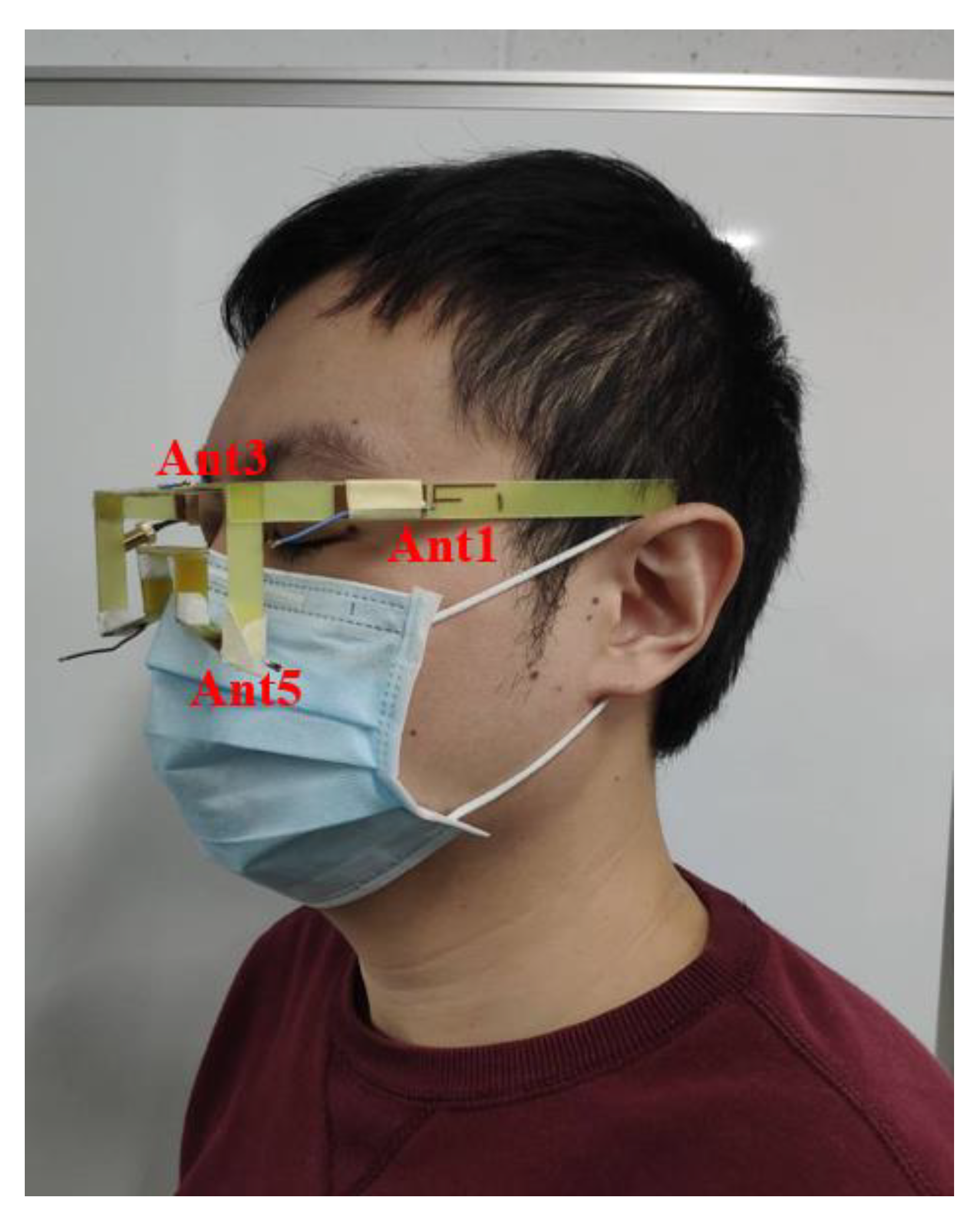 Electronics 11 00806 g014 550