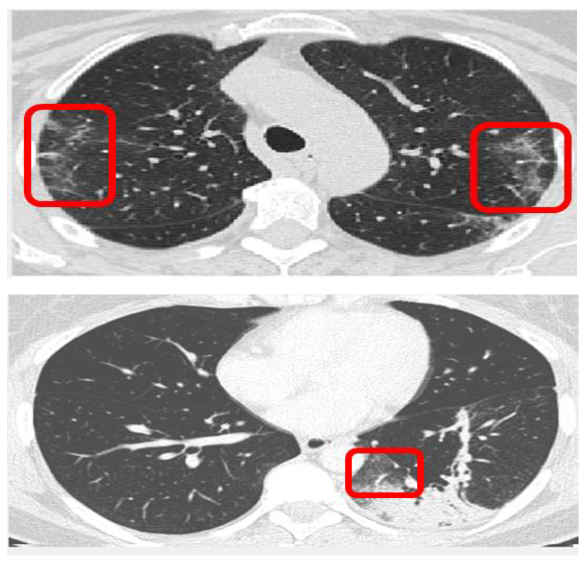 Electronics 11 01148 g001 550