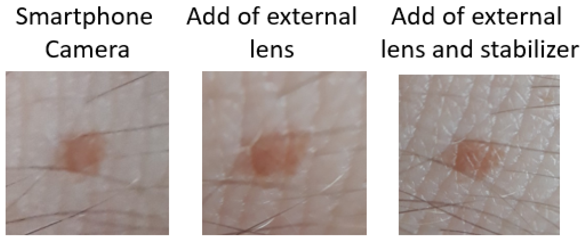 Electronics 11 01294 g008 550