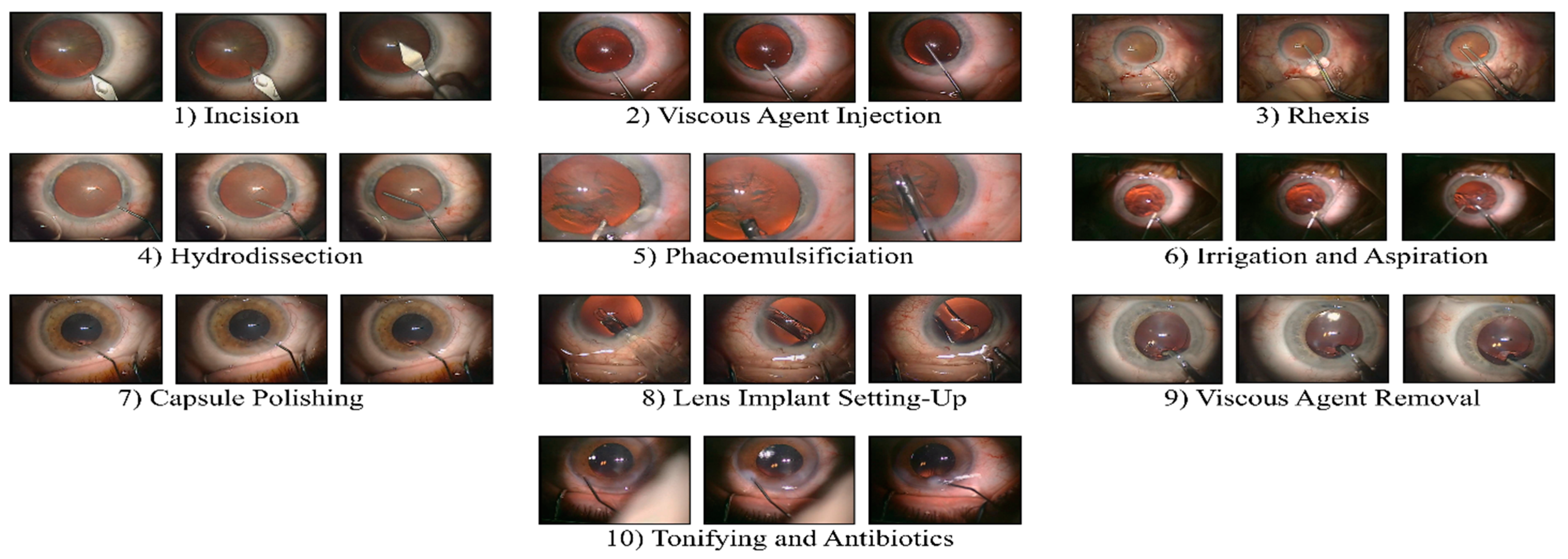 Electronics 11 01353 g006