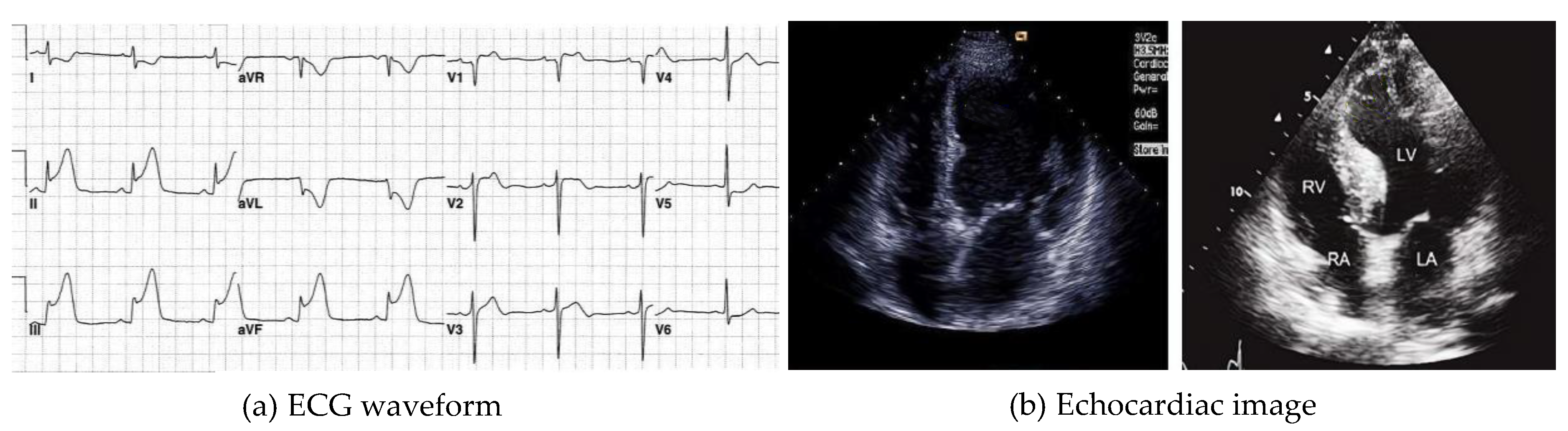 Electronics 11 01495 g002