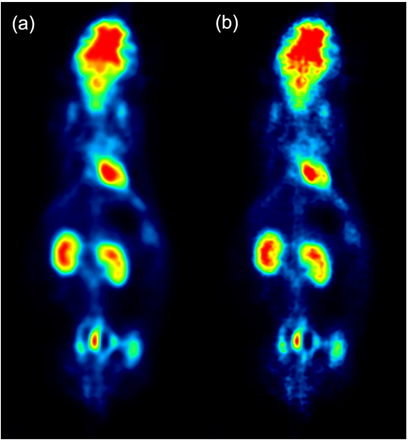 Optimization of Spatial Resolution and Image Reconstruction Parameters ...
