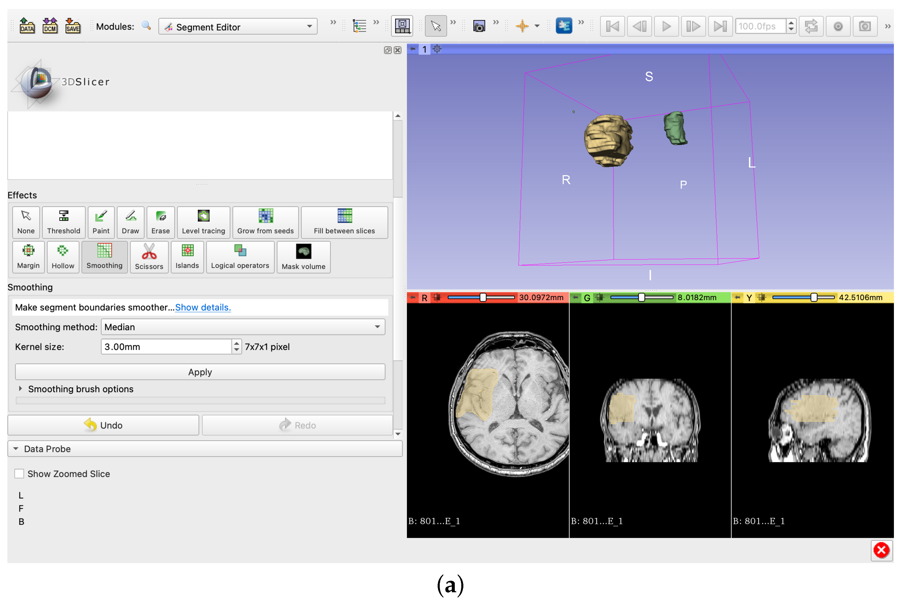 Electronics 11 01573 g004a