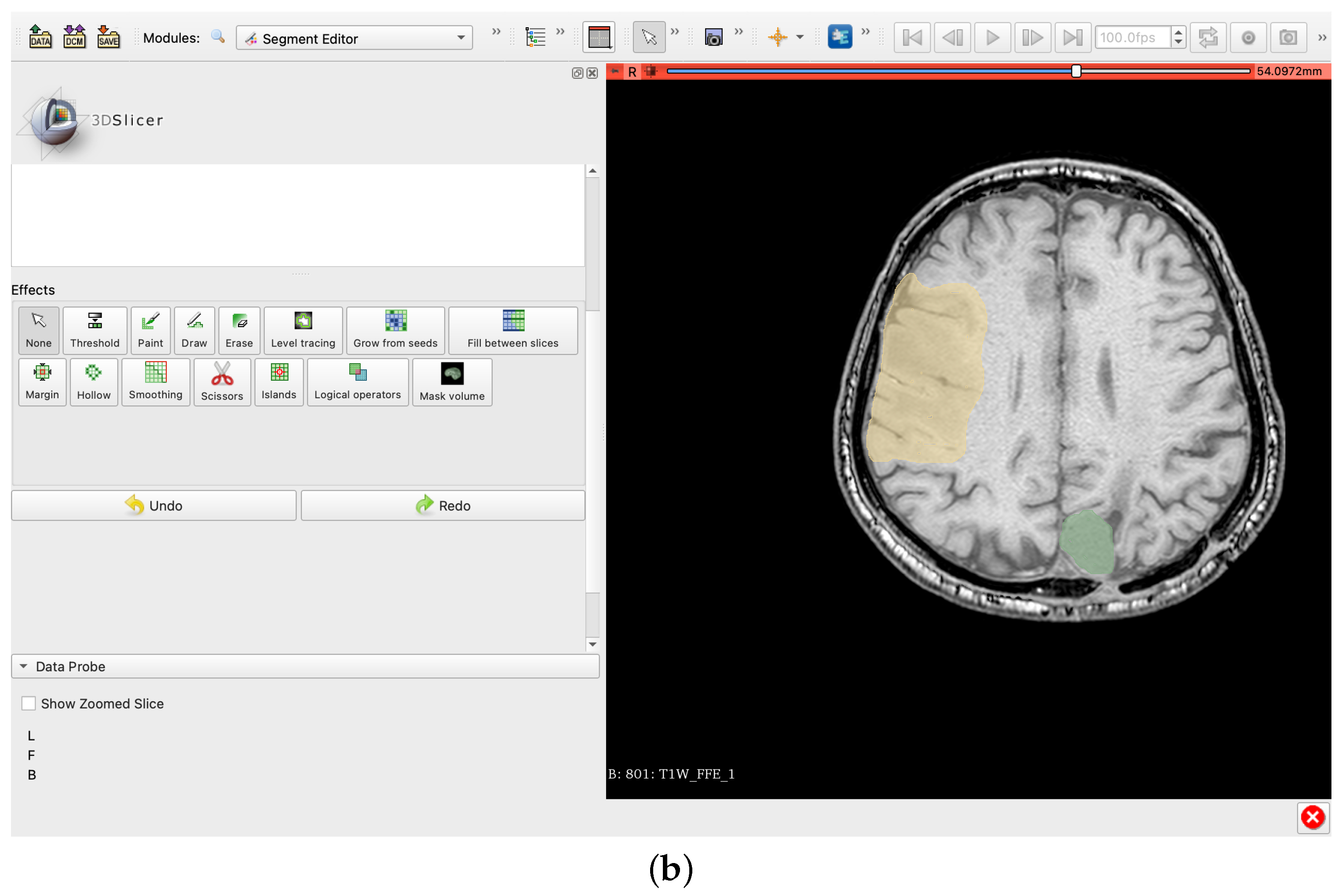 Electronics 11 01573 g004b