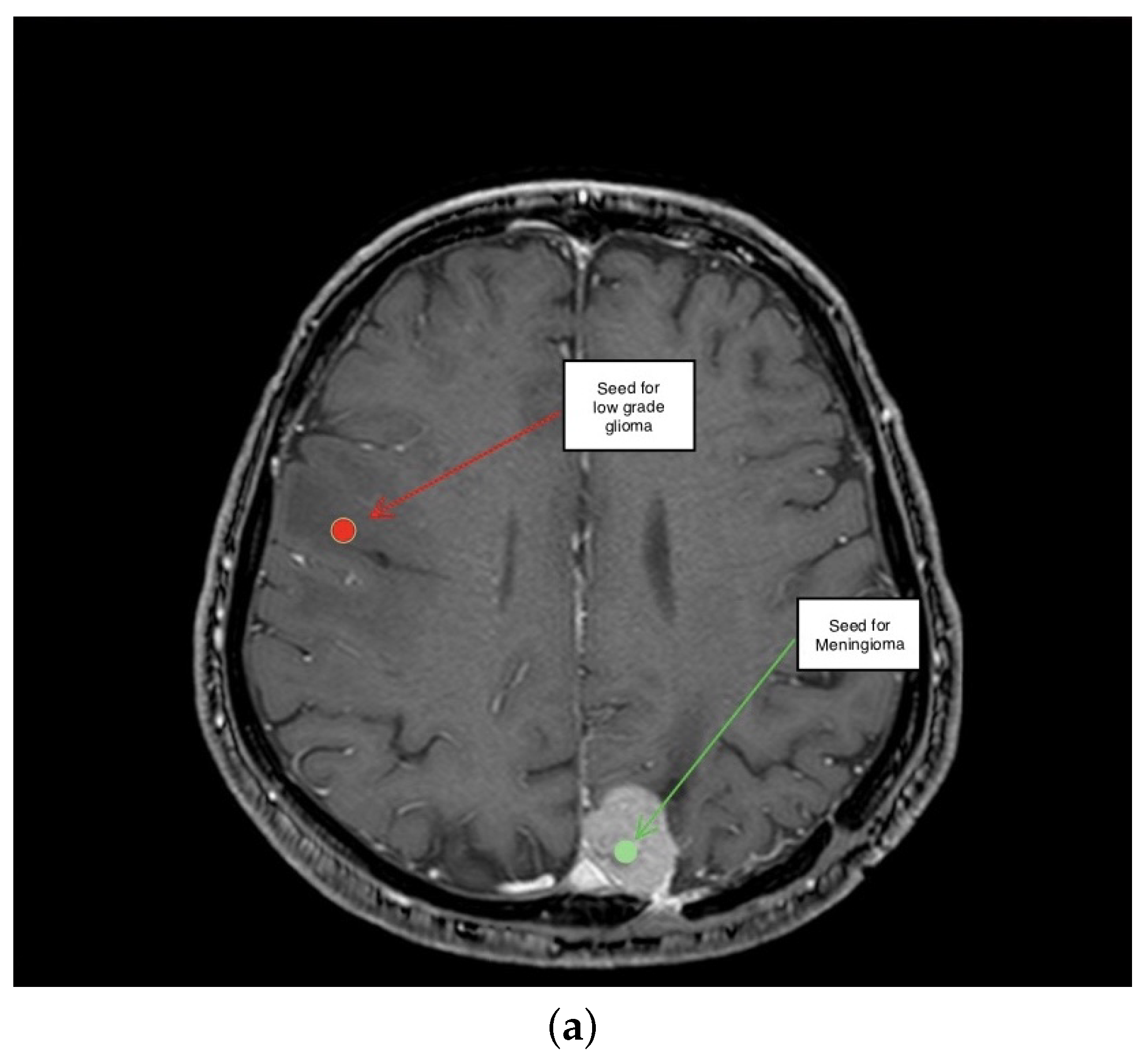 Electronics 11 01573 g005a