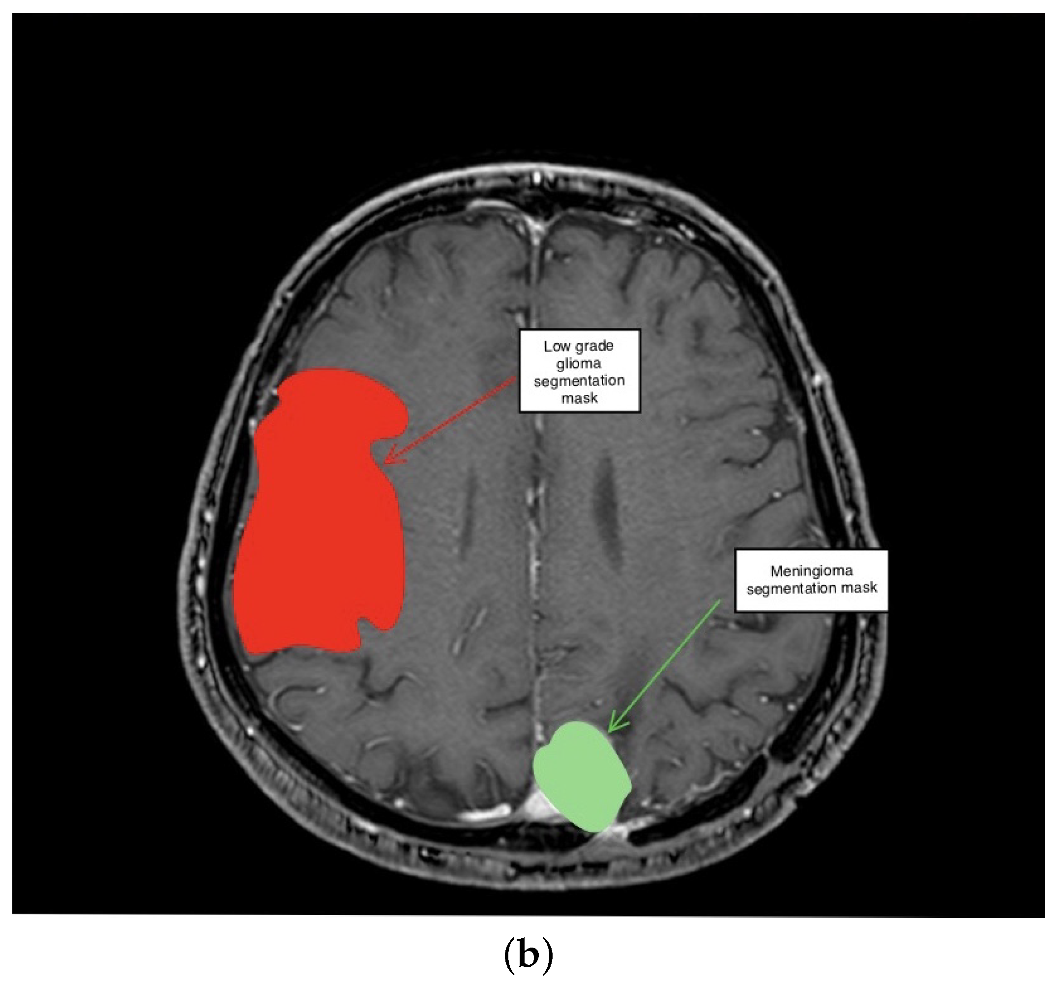 Electronics 11 01573 g005b