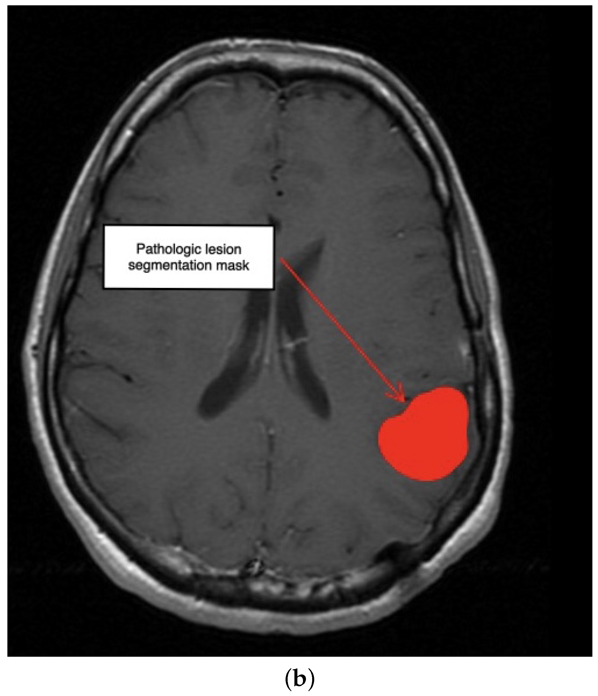 Electronics 11 01573 g007b