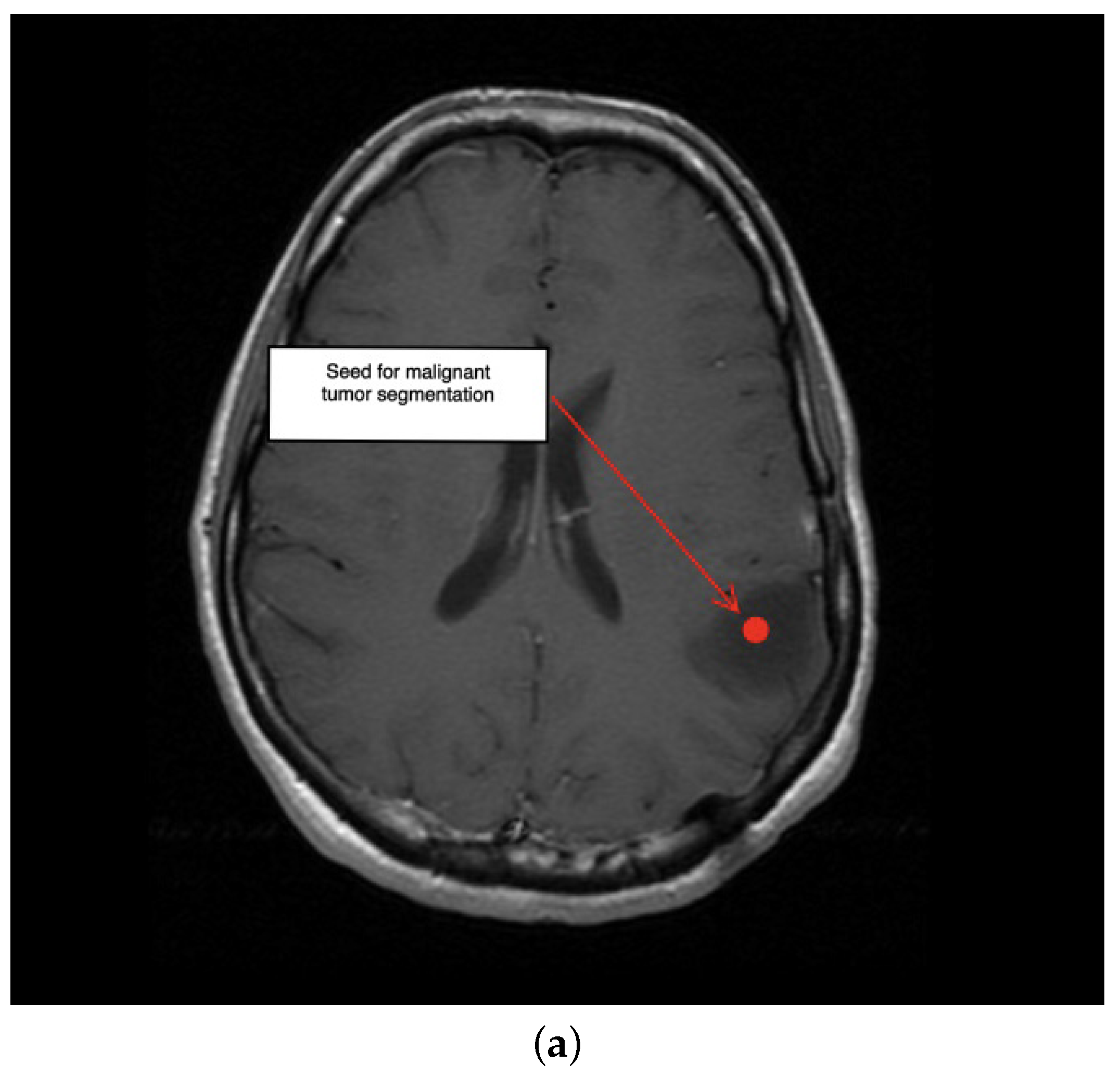 Electronics 11 01573 g008a