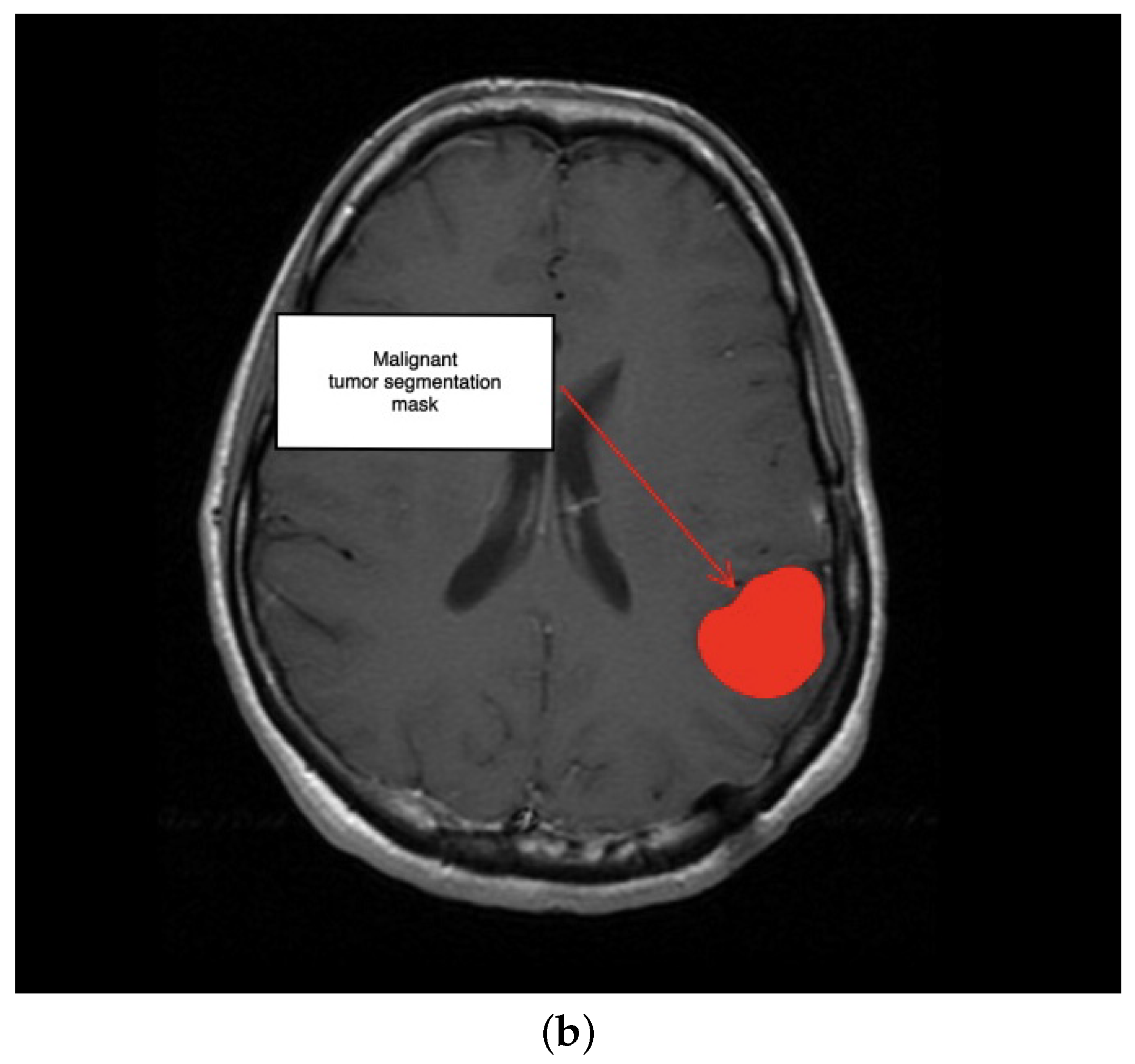 Electronics 11 01573 g008b
