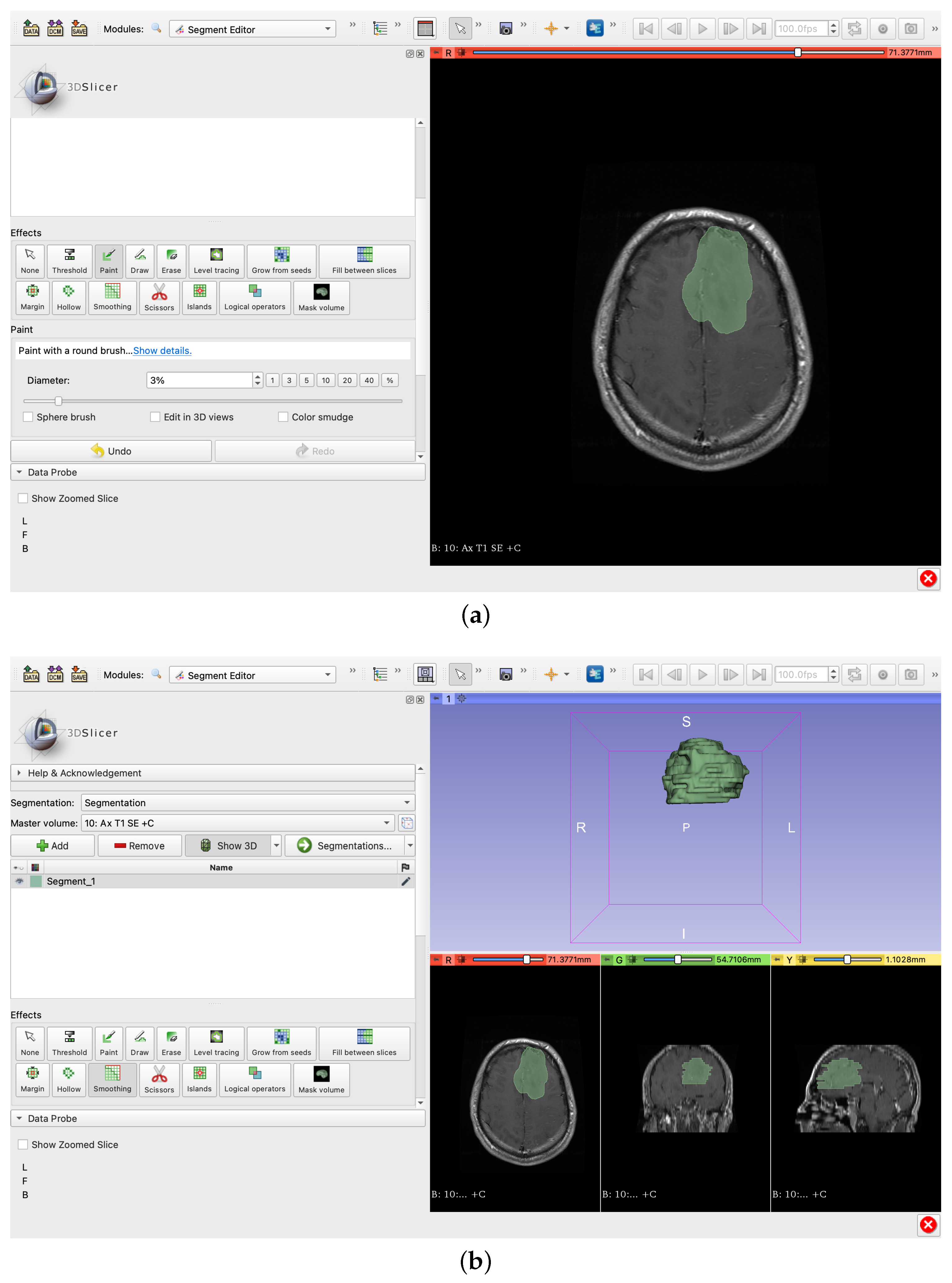 Electronics 11 01573 g011