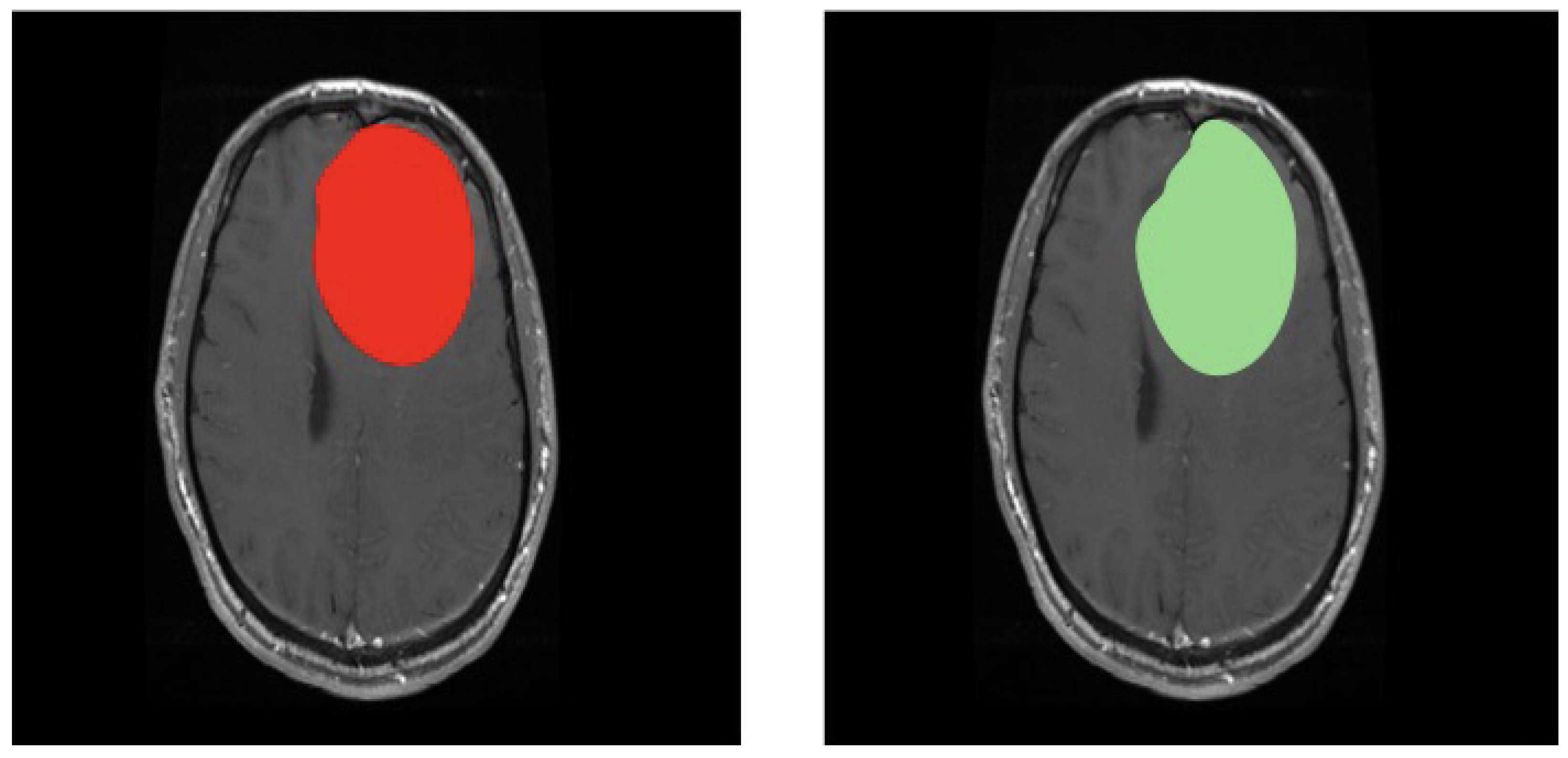 Electronics 11 01573 g013