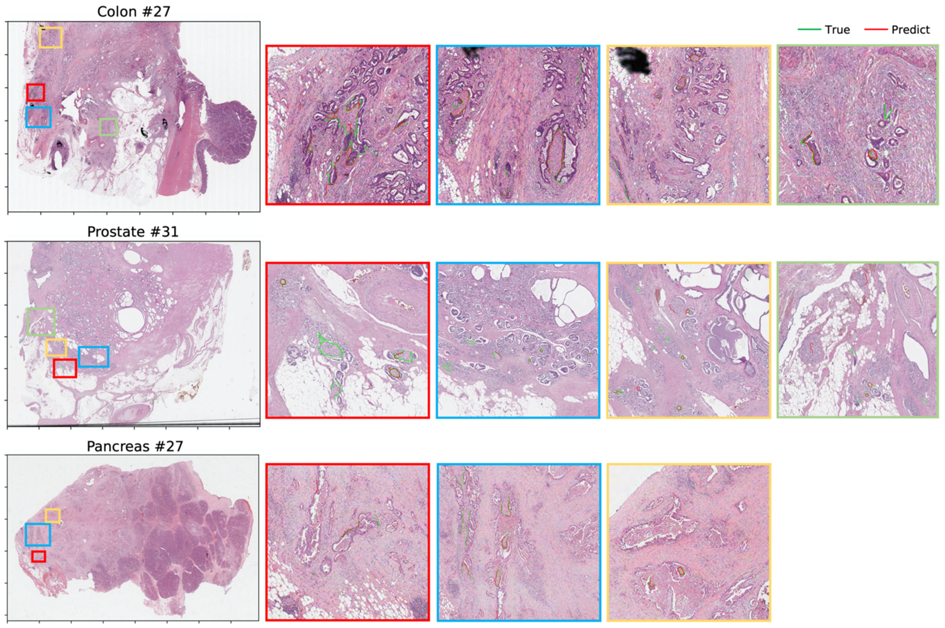 Electronics 11 01649 g008