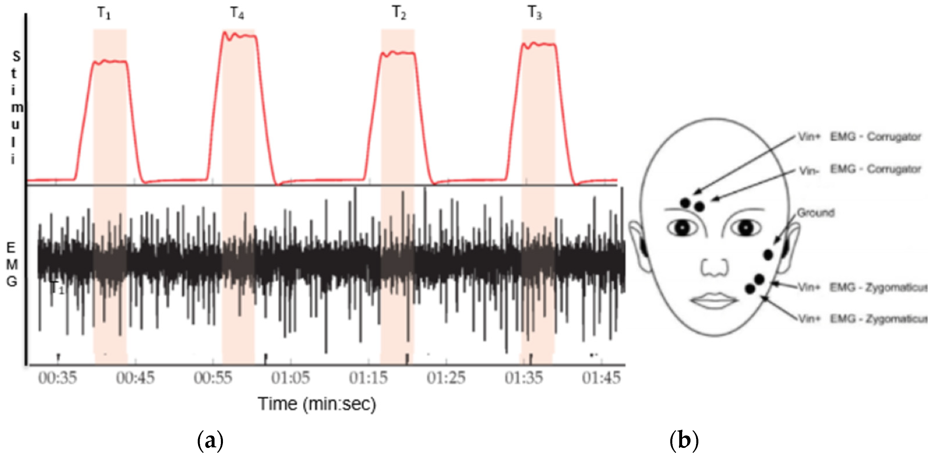 Electronics 11 01671 g003 550