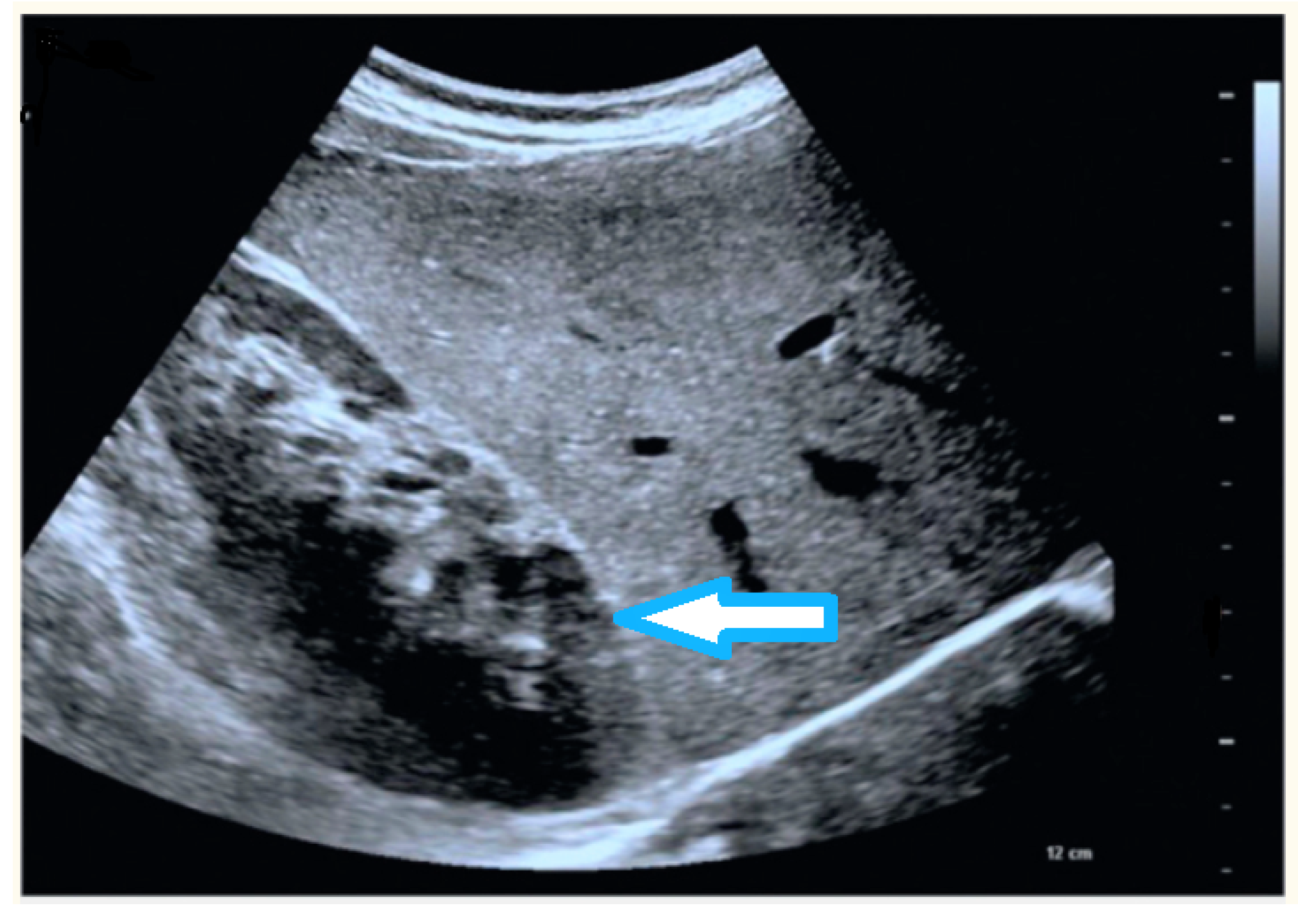 Electronics 11 01800 g002