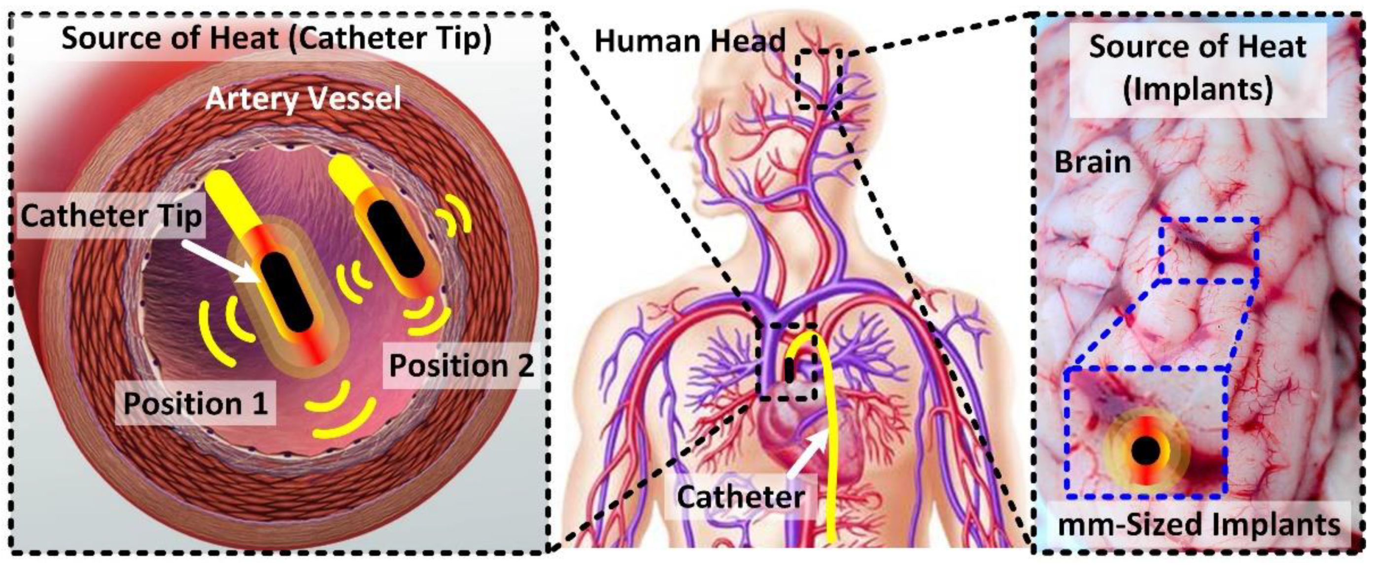 Electronics 11 01878 g001 550