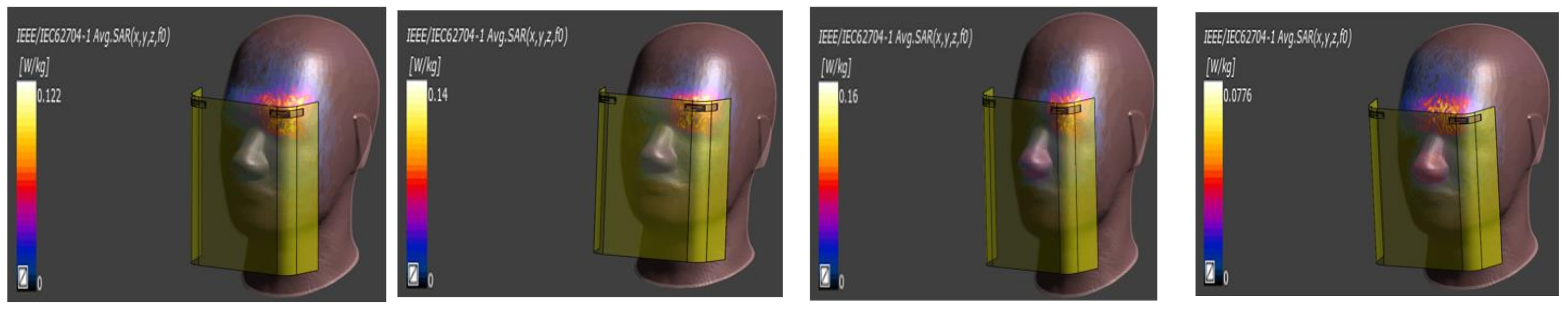 Electronics 11 01983 g039