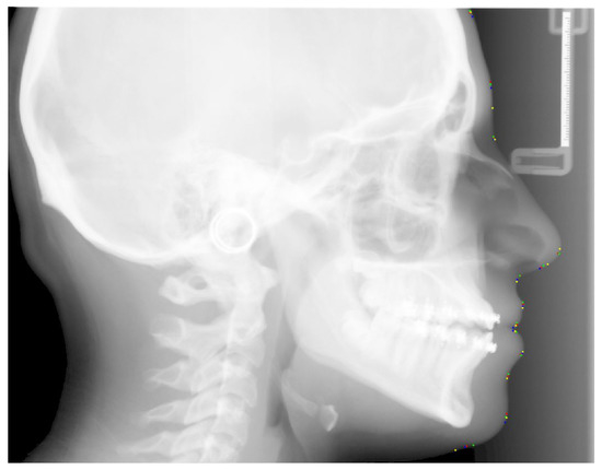 Radiographic Cephalometry 歯科　本　矯正 Radiographic Cephalometry: From Basics to 3-d Imaging