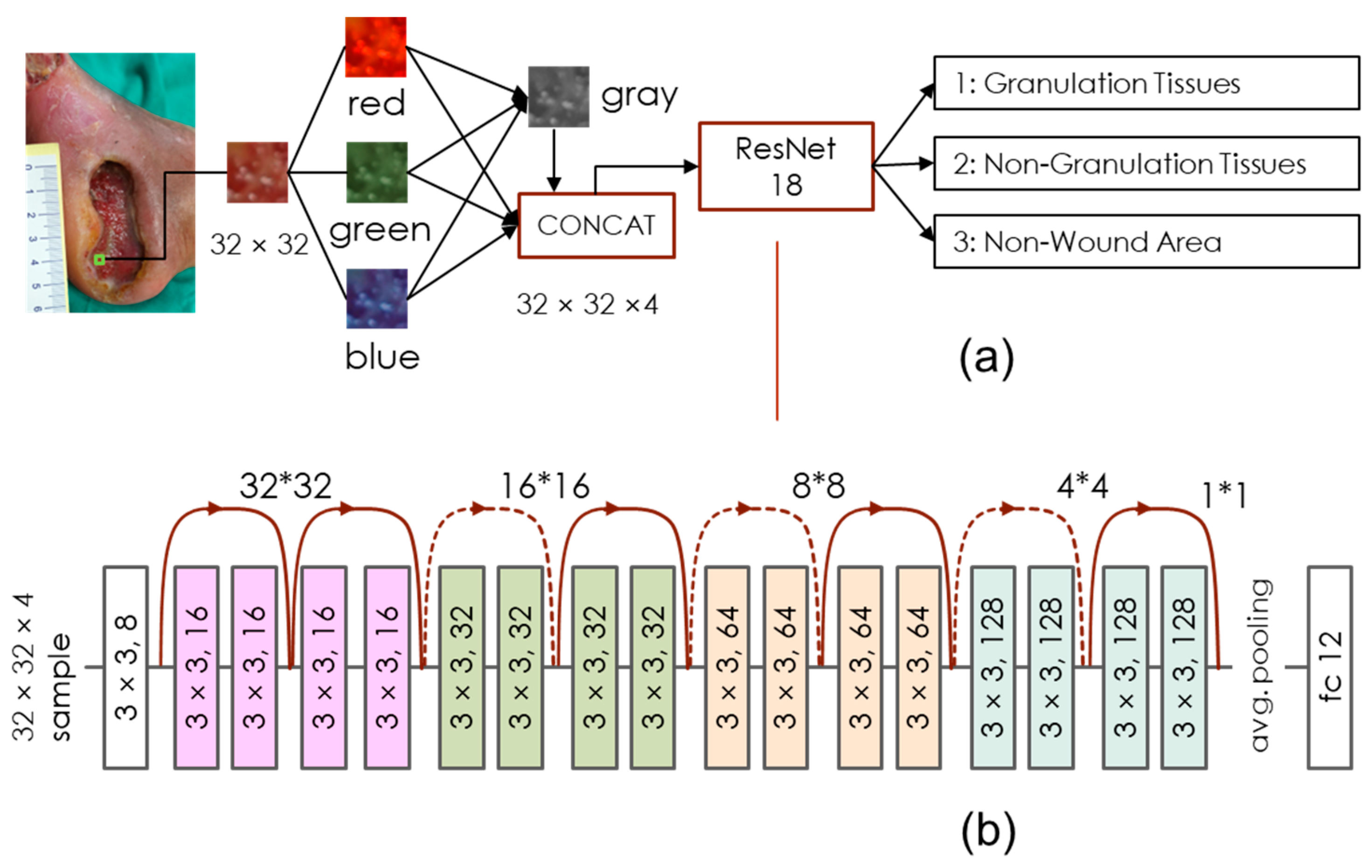 Electronics Free FullText A Granulation Tissue Detection Model to