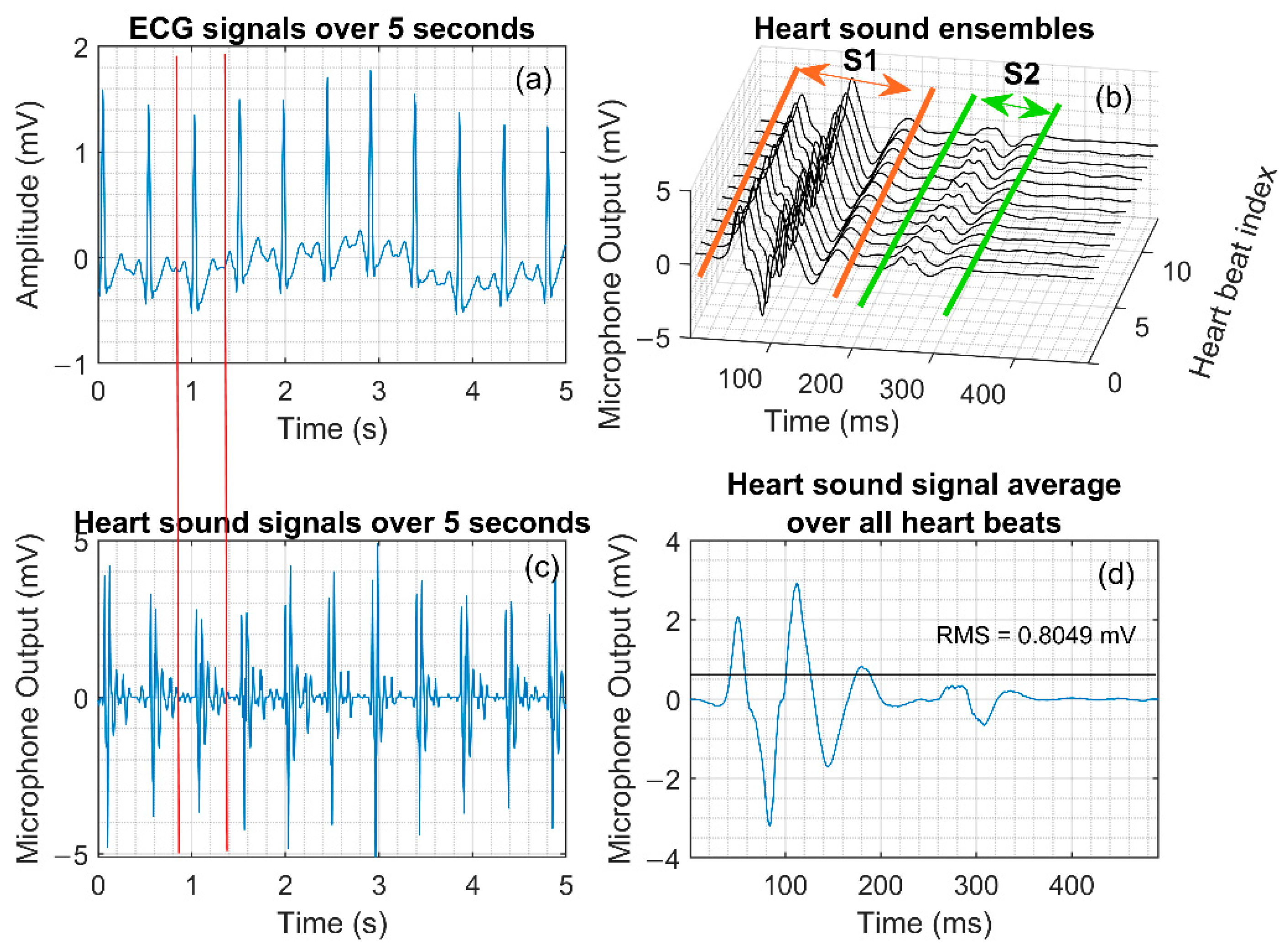 Electronics Free FullText Evaluation of Signal Quality from a