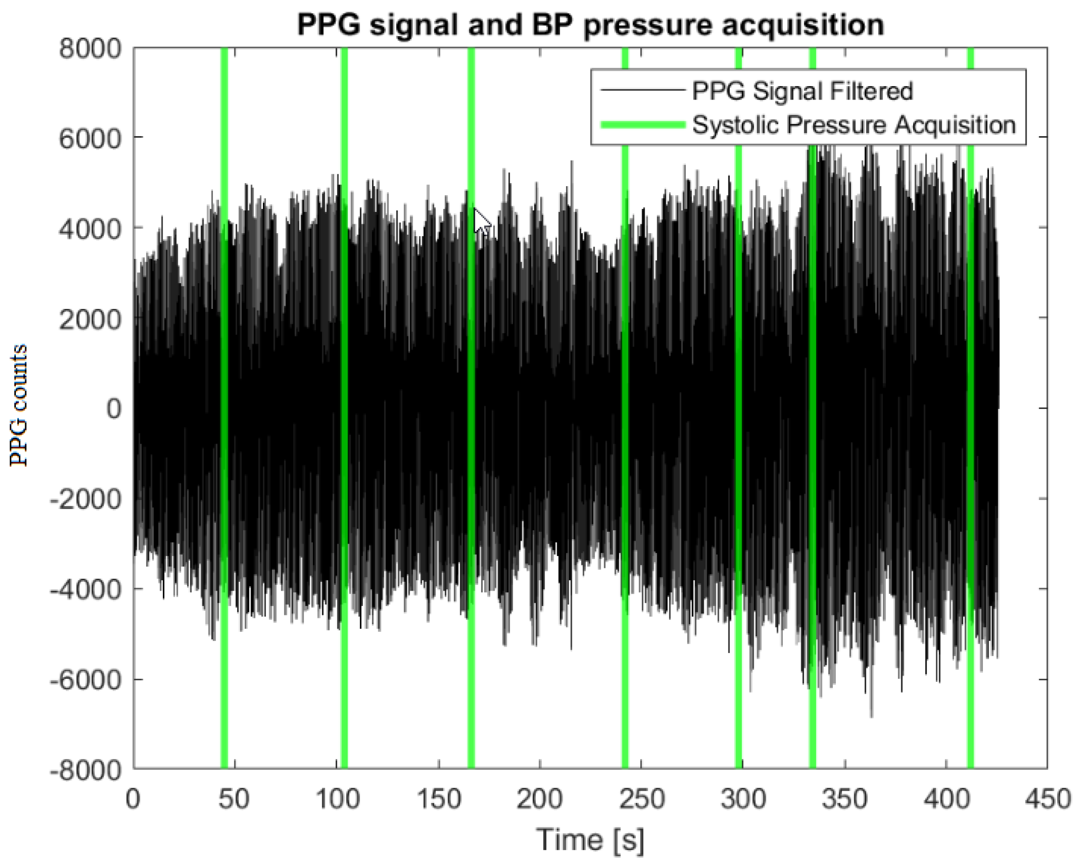 Systolic Blood Pressure Estimation from PPG Signal Using ANN