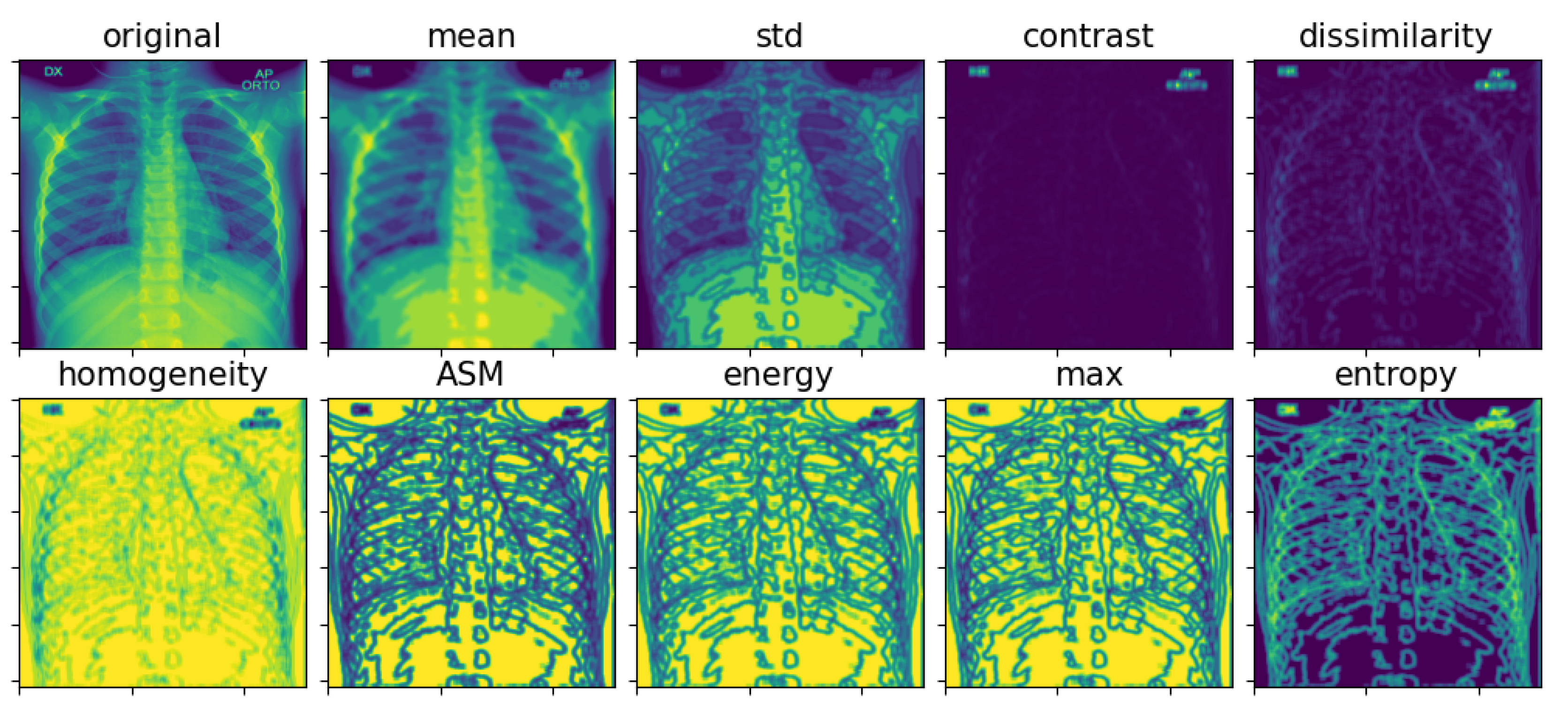 Electronics 11 03511 g005
